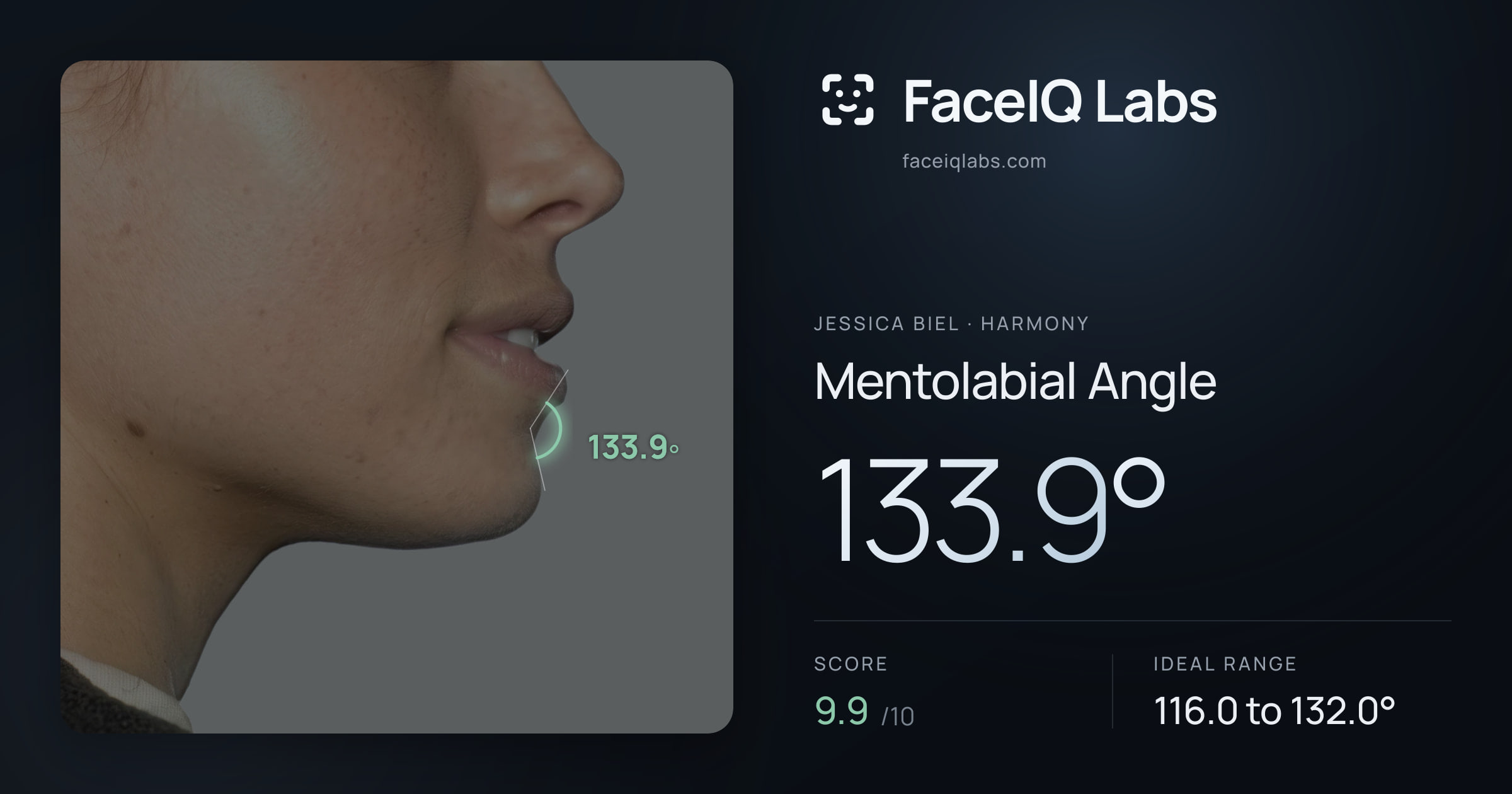 Jessica Biel Mentolabial Angle: 133.9°, drawn on the photo