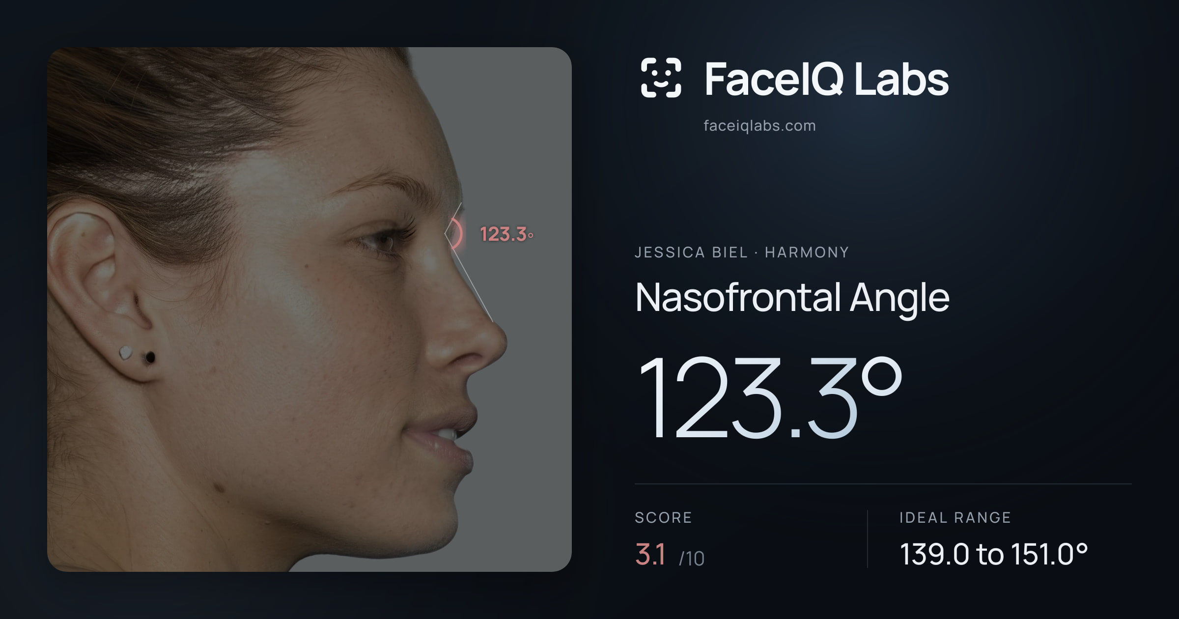 Jessica Biel Nasofrontal Angle: 123.3°, drawn on the photo
