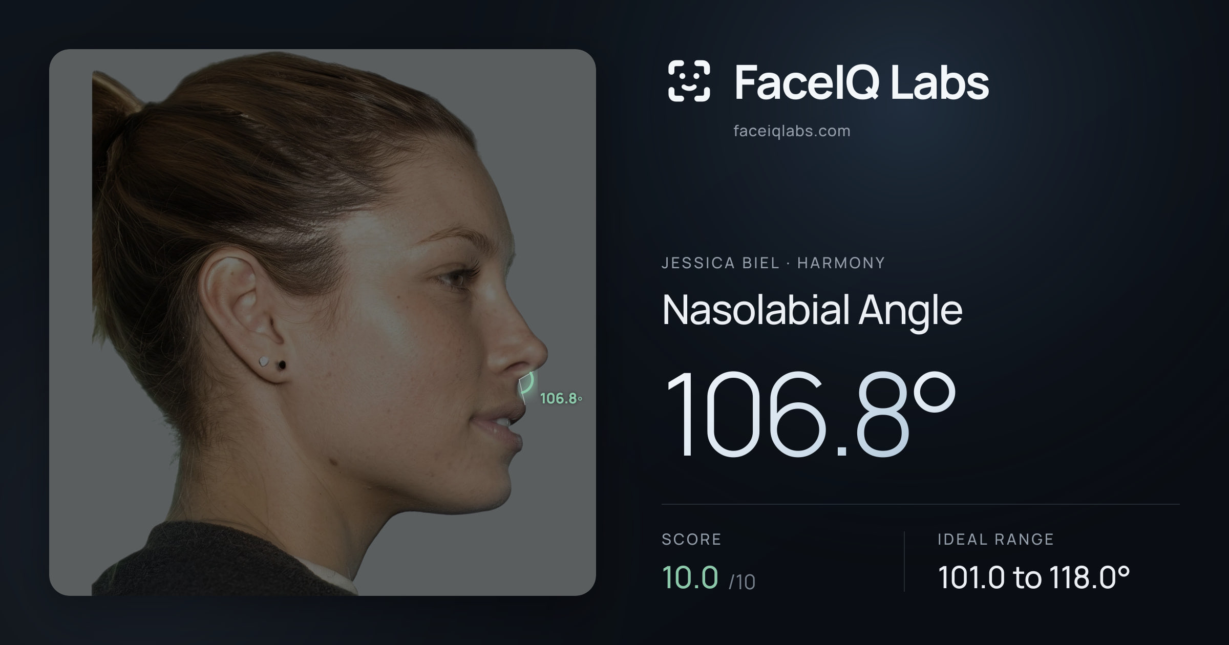Jessica Biel Nasolabial Angle: 106.8°, drawn on the photo