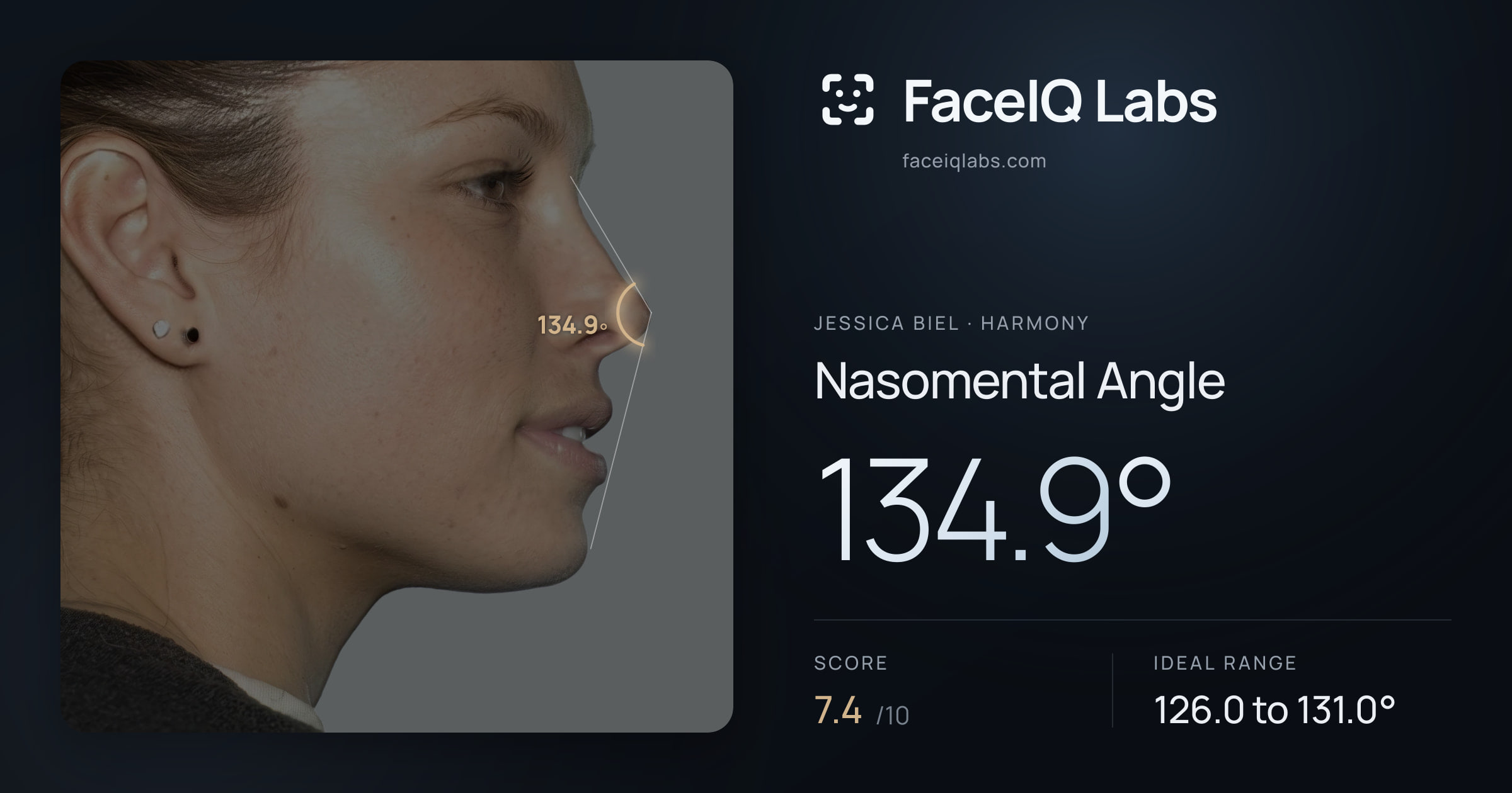 Jessica Biel Nasomental Angle: 134.9°, drawn on the photo