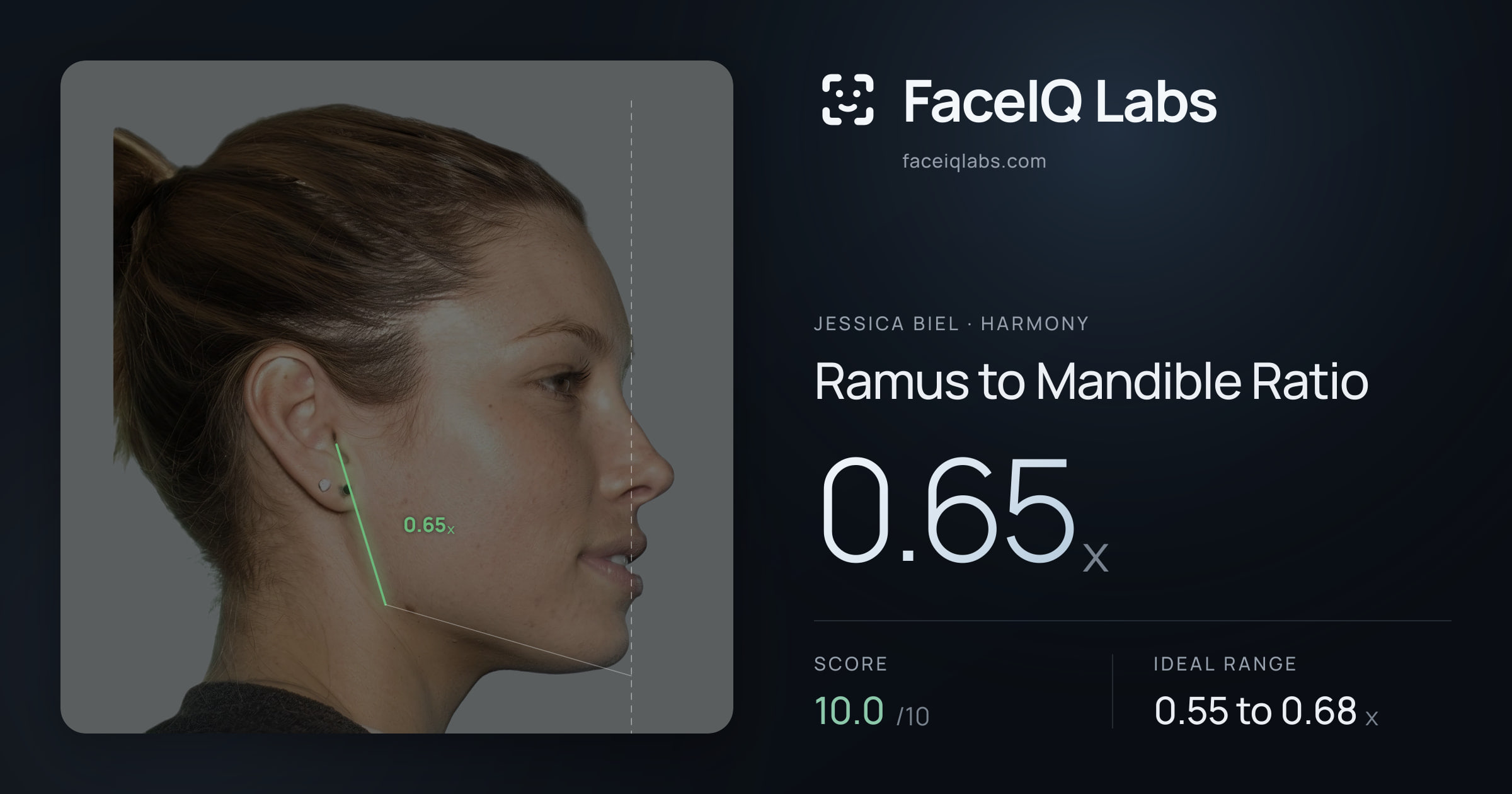 Jessica Biel Ramus to Mandible Ratio: 0.65x, drawn on the photo