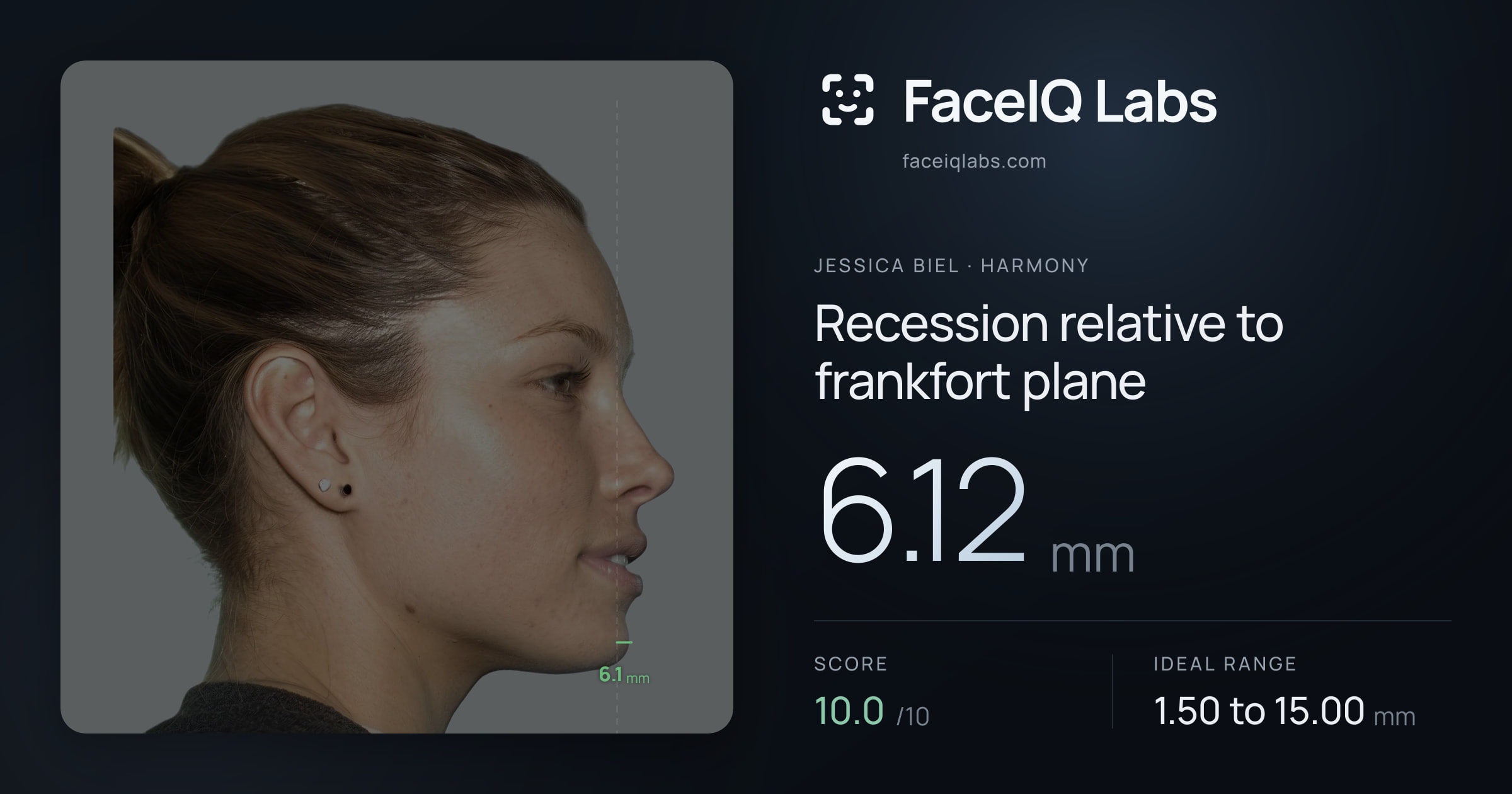 Jessica Biel Recession relative to frankfort plane: 6.12mm, drawn on the photo