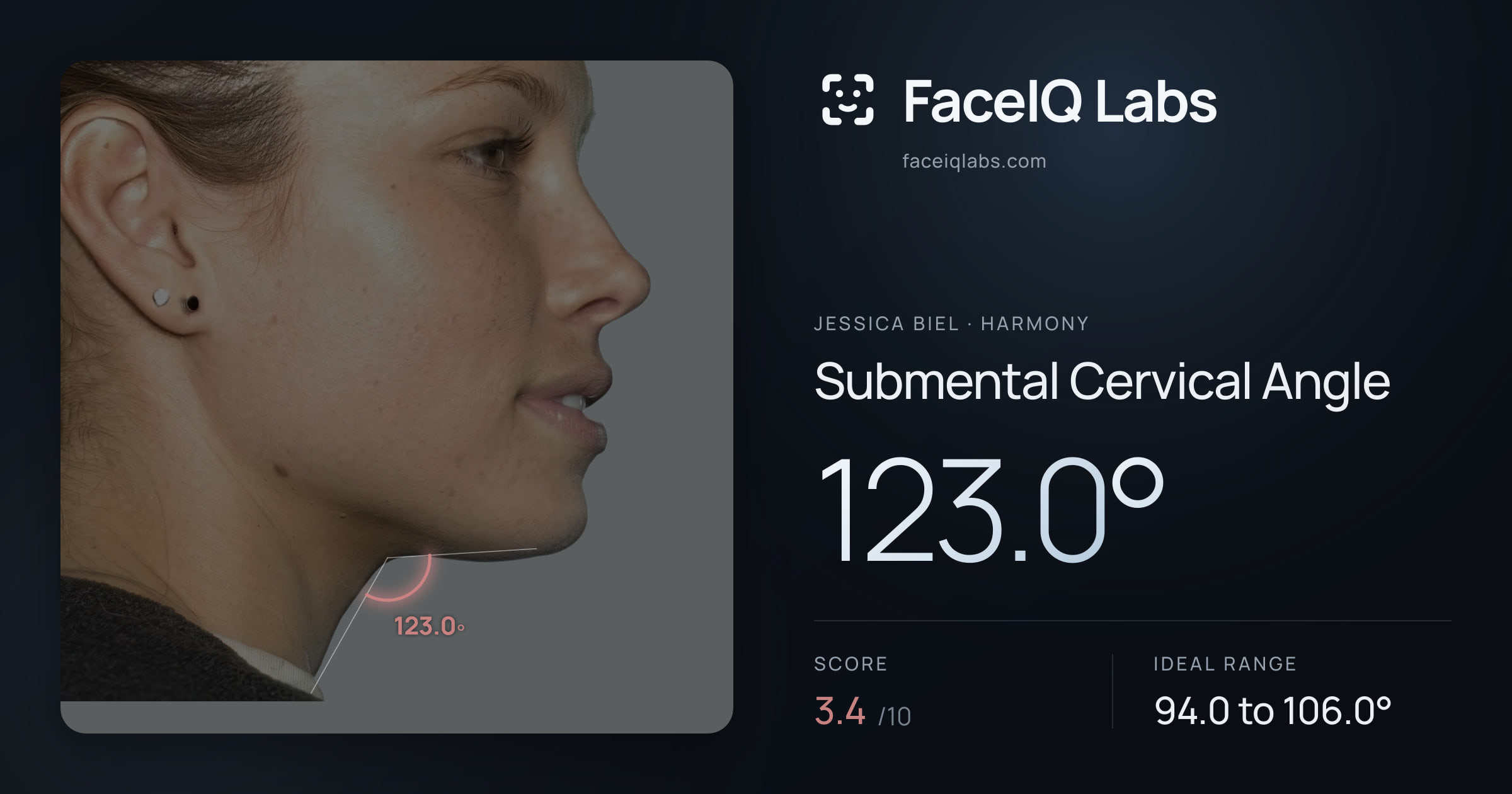 Jessica Biel Submental Cervical Angle: 123.0°, drawn on the photo