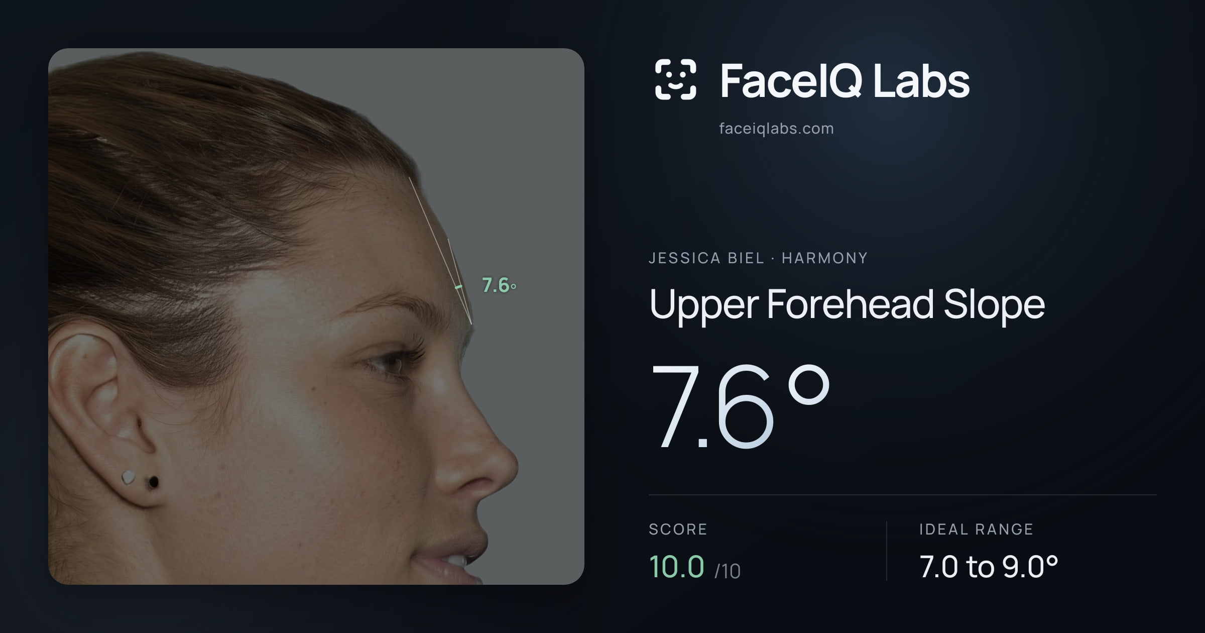 Jessica Biel Upper Forehead Slope: 7.6°, drawn on the photo