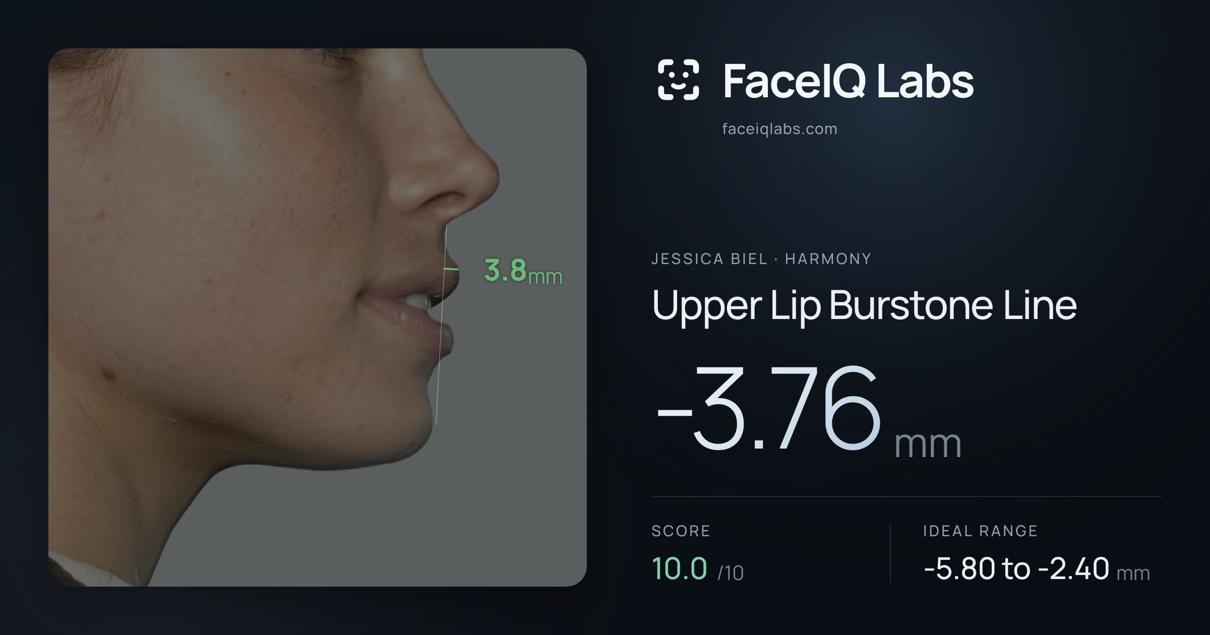 Jessica Biel Upper Lip Burstone Line: -3.76mm, drawn on the photo