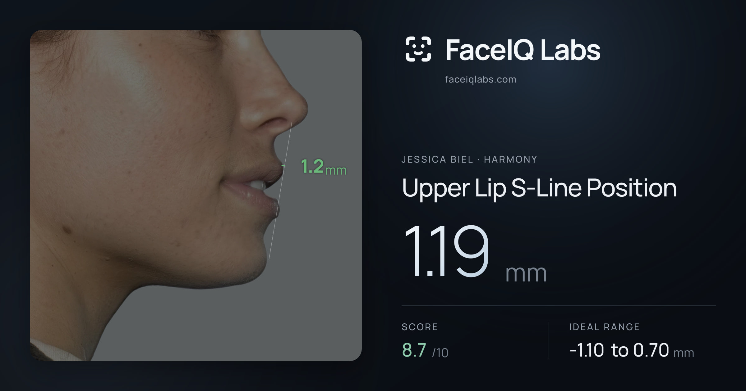 Jessica Biel Upper Lip S-Line Position: 1.19mm, drawn on the photo
