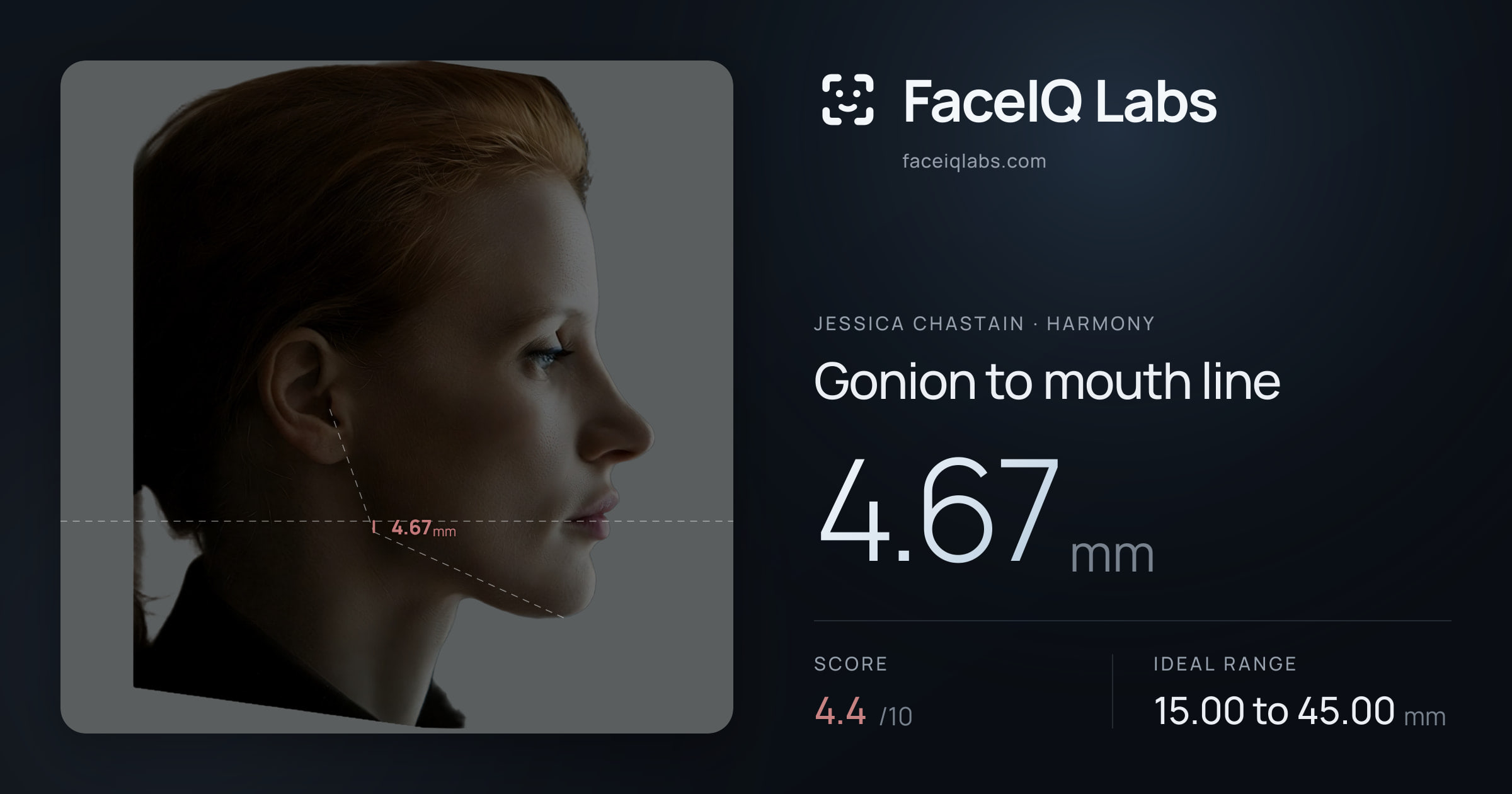 Jessica Chastain Gonion to mouth line: 4.67mm, drawn on the photo