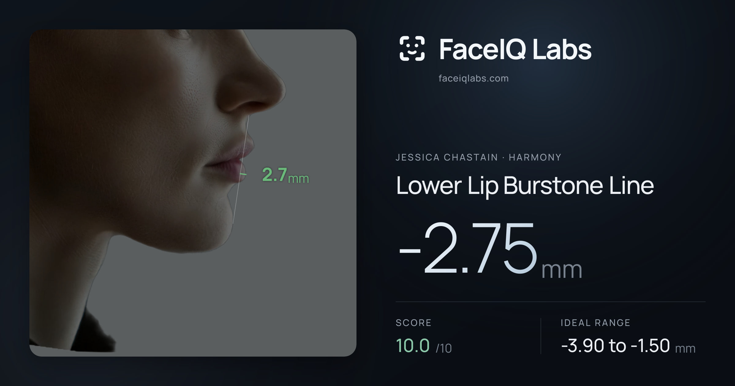Jessica Chastain Lower Lip Burstone Line: -2.75mm, drawn on the photo