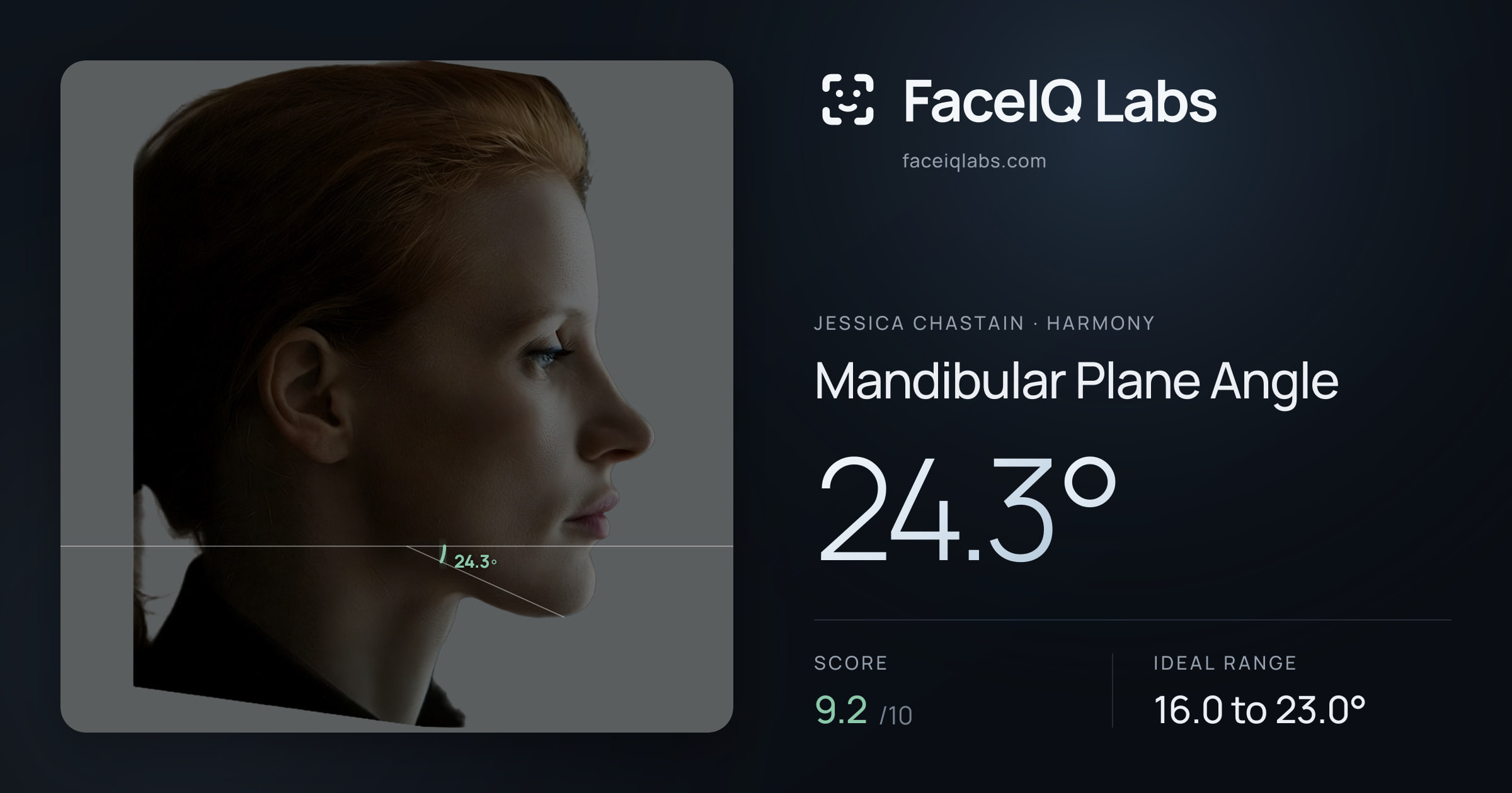 Jessica Chastain Mandibular Plane Angle: 24.3°, drawn on the photo