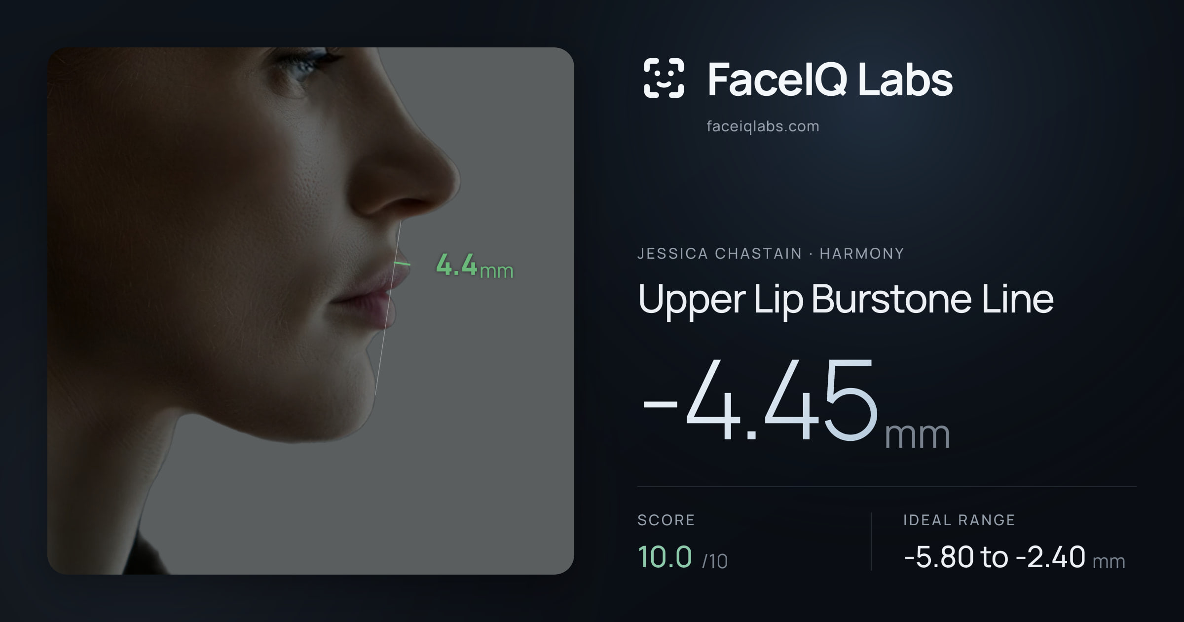 Jessica Chastain Upper Lip Burstone Line: -4.45mm, drawn on the photo