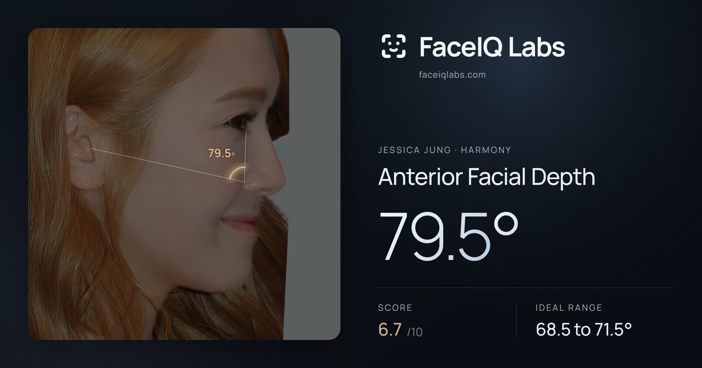 Jessica Jung Anterior Facial Depth: 79.5°, drawn on the photo