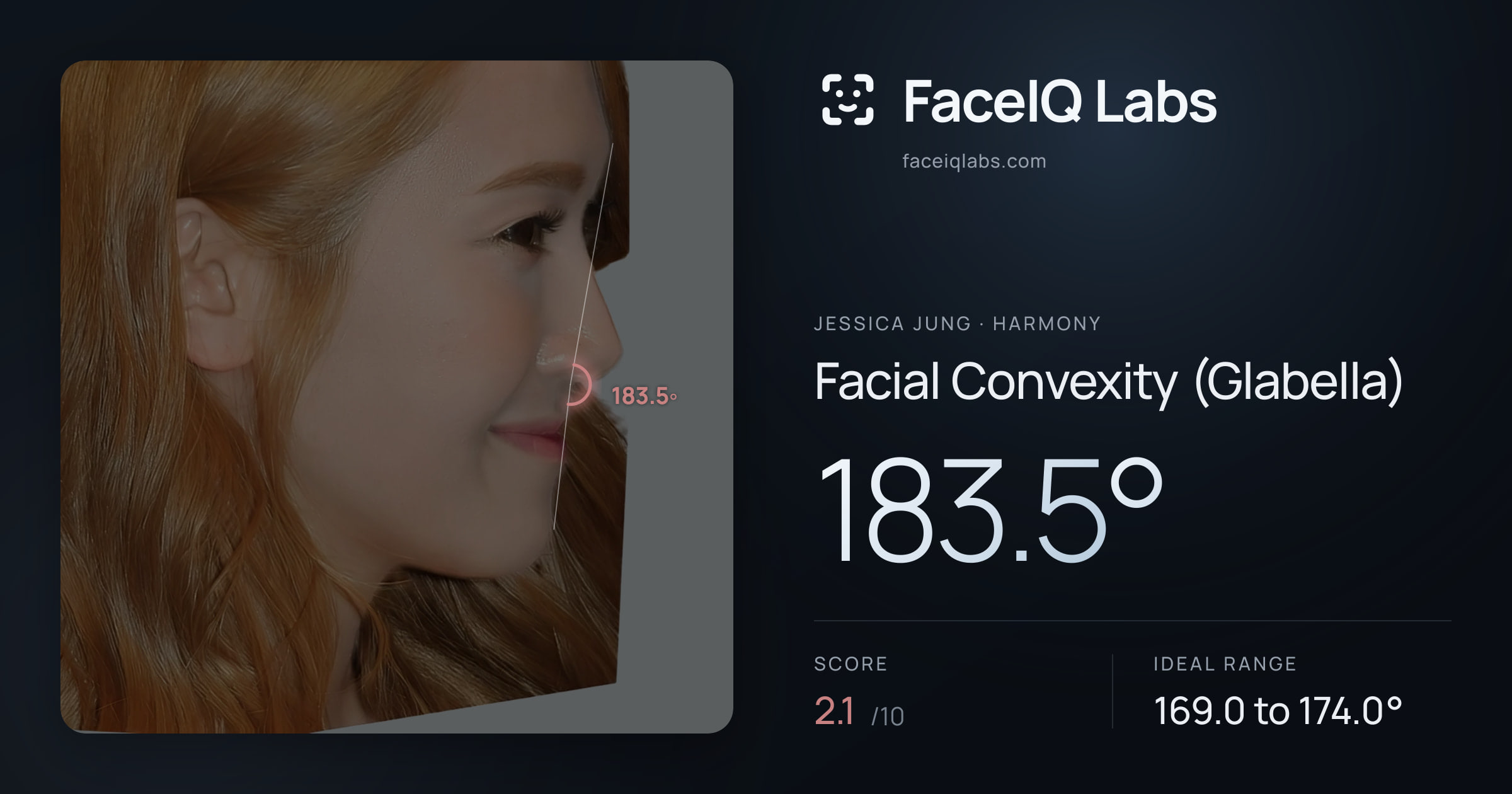 Jessica Jung Facial Convexity (Glabella): 183.5°, drawn on the photo
