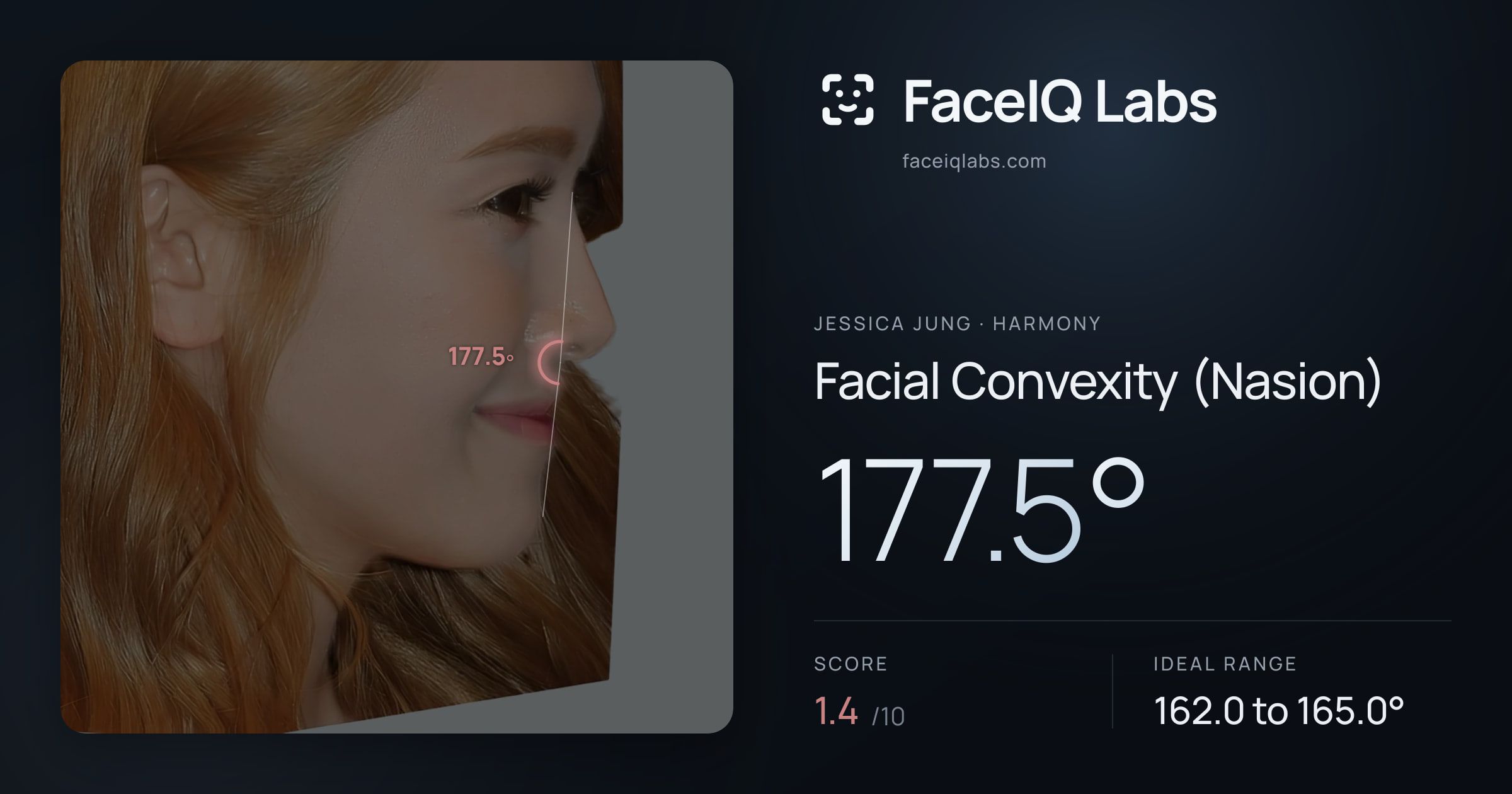 Jessica Jung Facial Convexity (Nasion): 177.5°, drawn on the photo