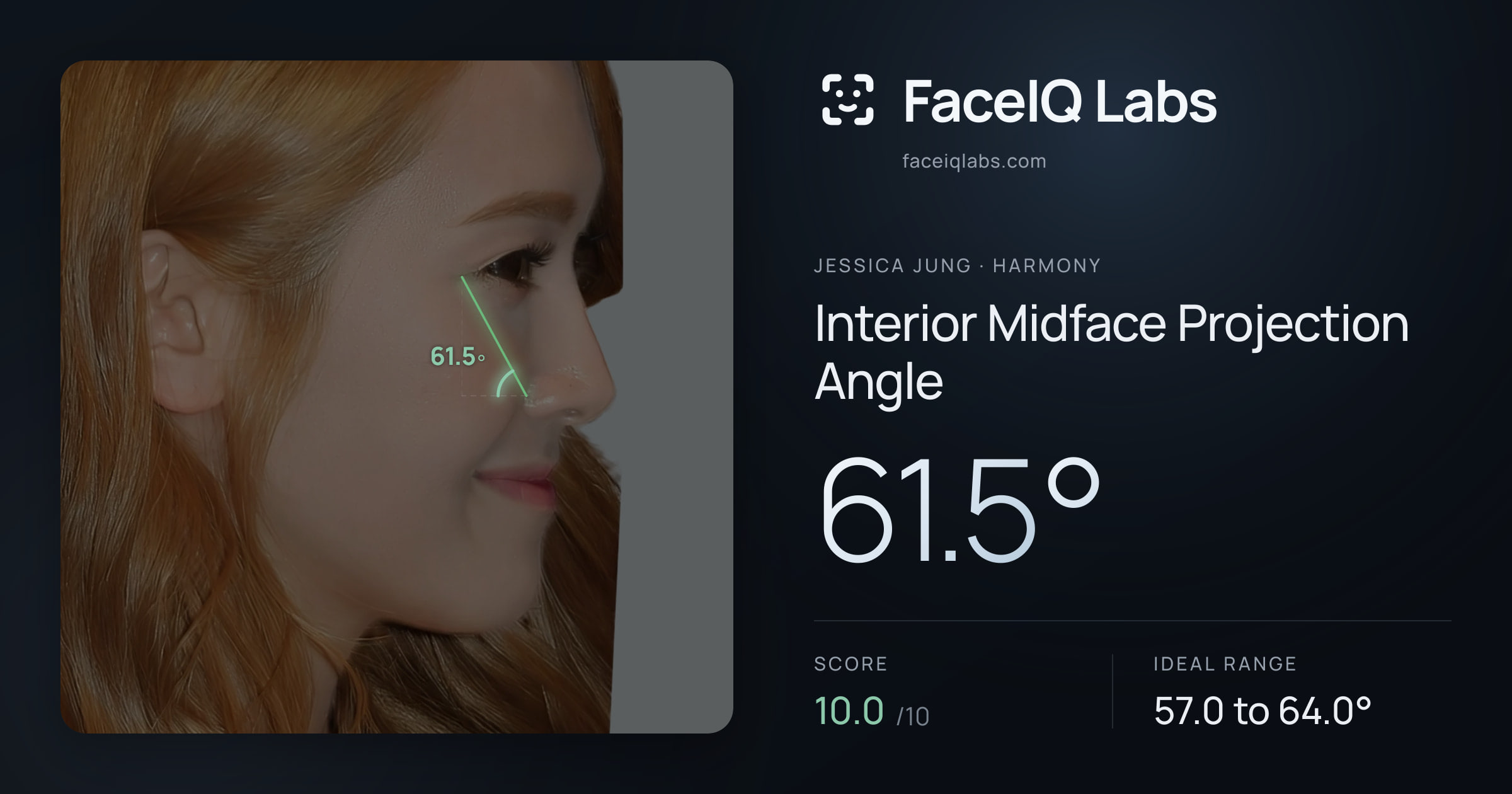 Jessica Jung Interior Midface Projection Angle: 61.5°, drawn on the photo