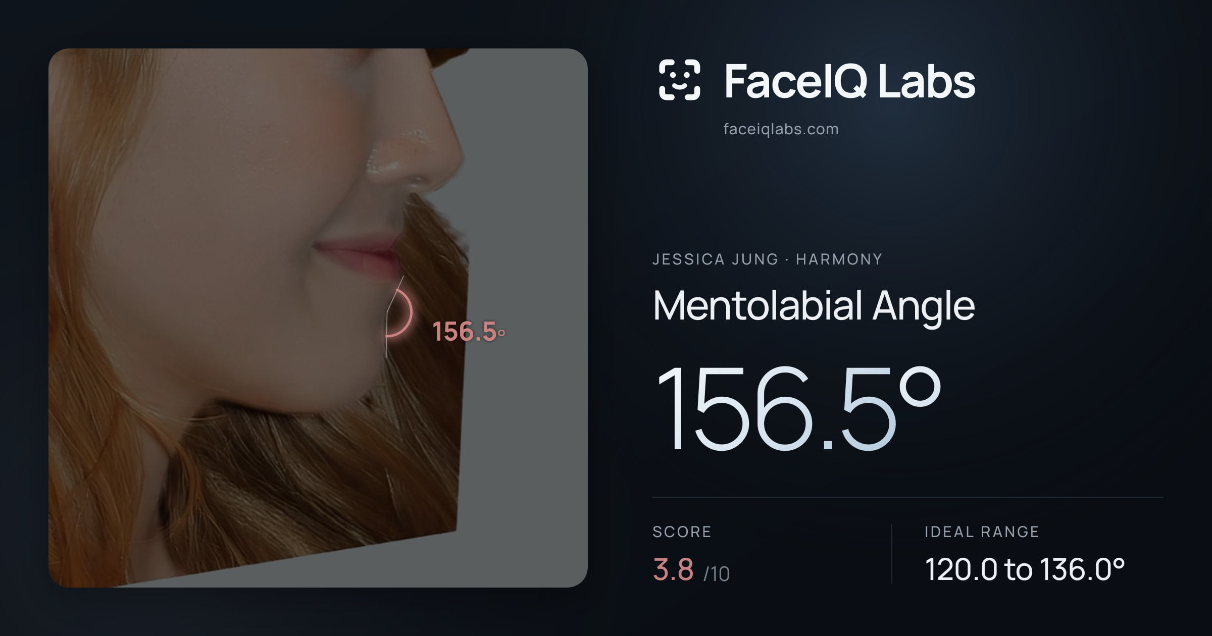 Jessica Jung Mentolabial Angle: 156.5°, drawn on the photo