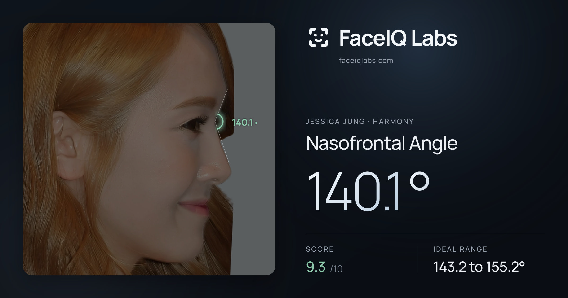 Jessica Jung Nasofrontal Angle: 140.1°, drawn on the photo