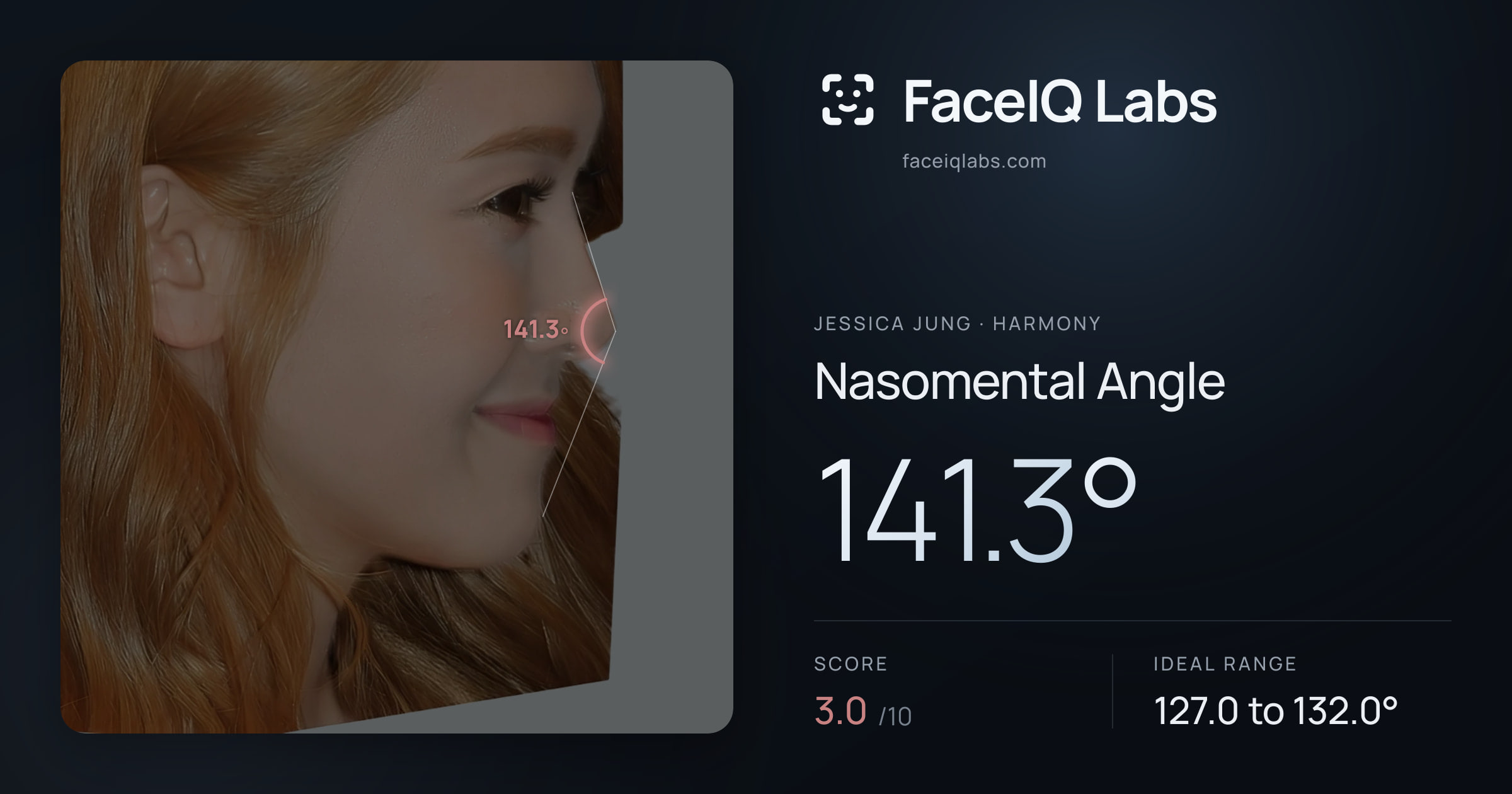 Jessica Jung Nasomental Angle: 141.3°, drawn on the photo