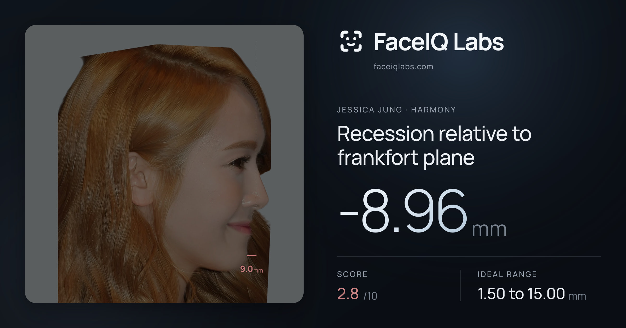 Jessica Jung Recession relative to frankfort plane: -8.96mm, drawn on the photo