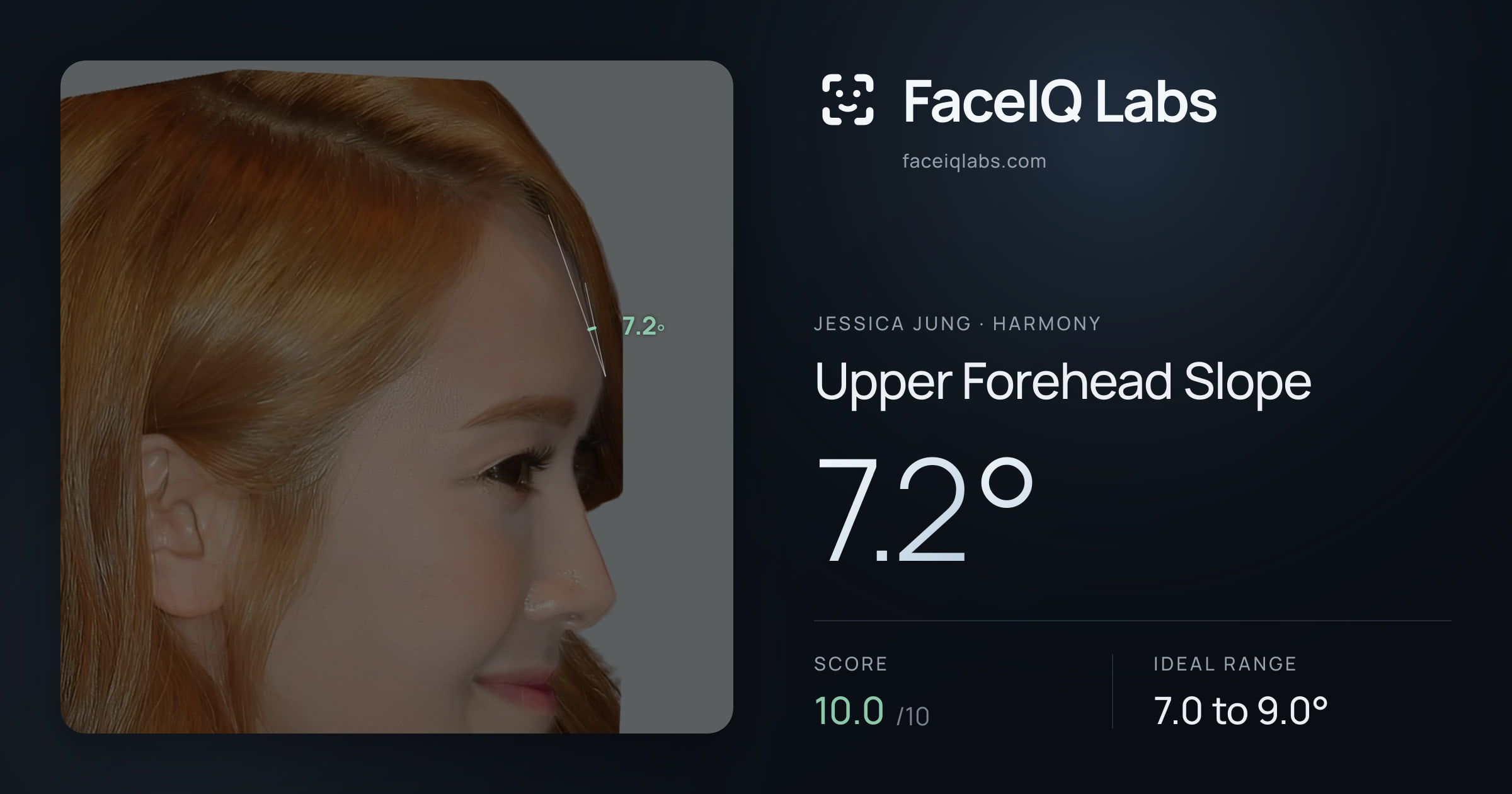 Jessica Jung Upper Forehead Slope: 7.2°, drawn on the photo