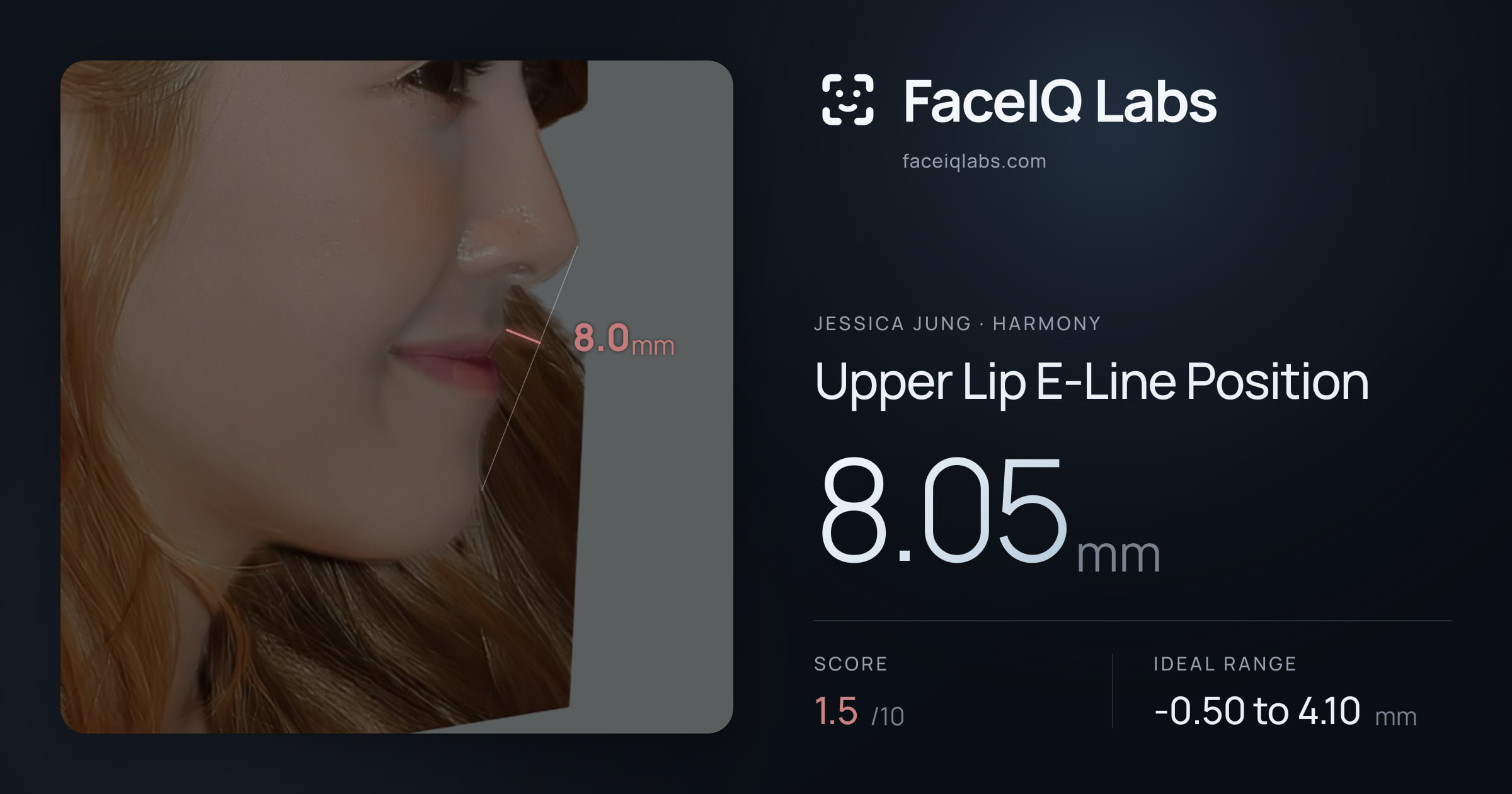 Jessica Jung Upper Lip E-Line Position: 8.05mm, drawn on the photo