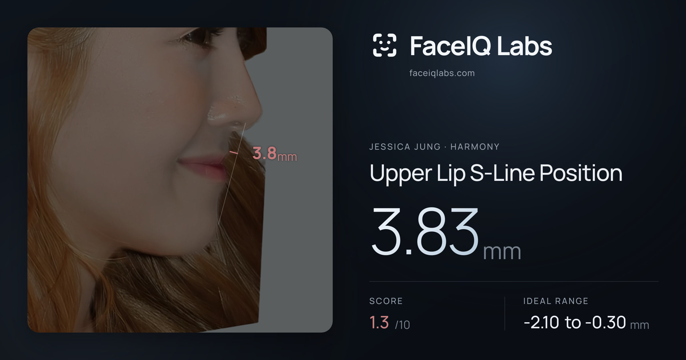 Jessica Jung Upper Lip S-Line Position: 3.83mm, drawn on the photo