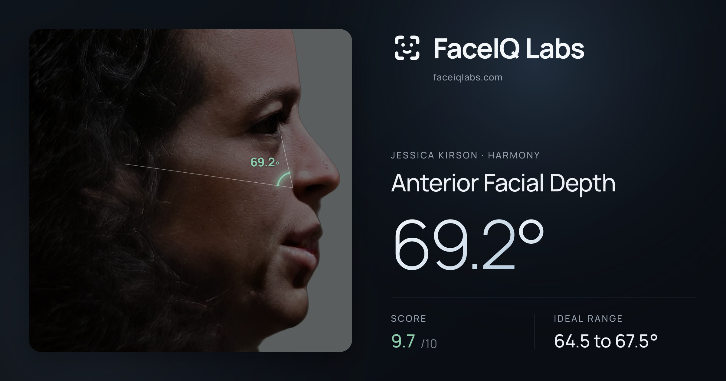 Jessica Kirson Anterior Facial Depth: 69.2°, drawn on the photo