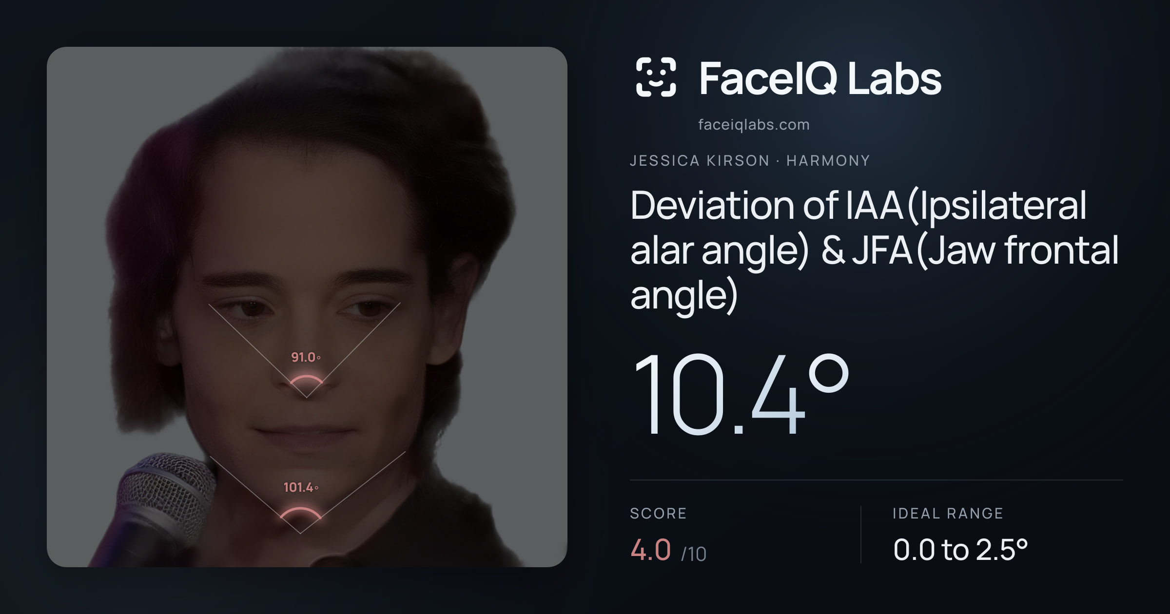 Jessica Kirson Deviation of IAA(Ipsilateral alar angle) & JFA(Jaw frontal angle): 10.4°, drawn on the photo