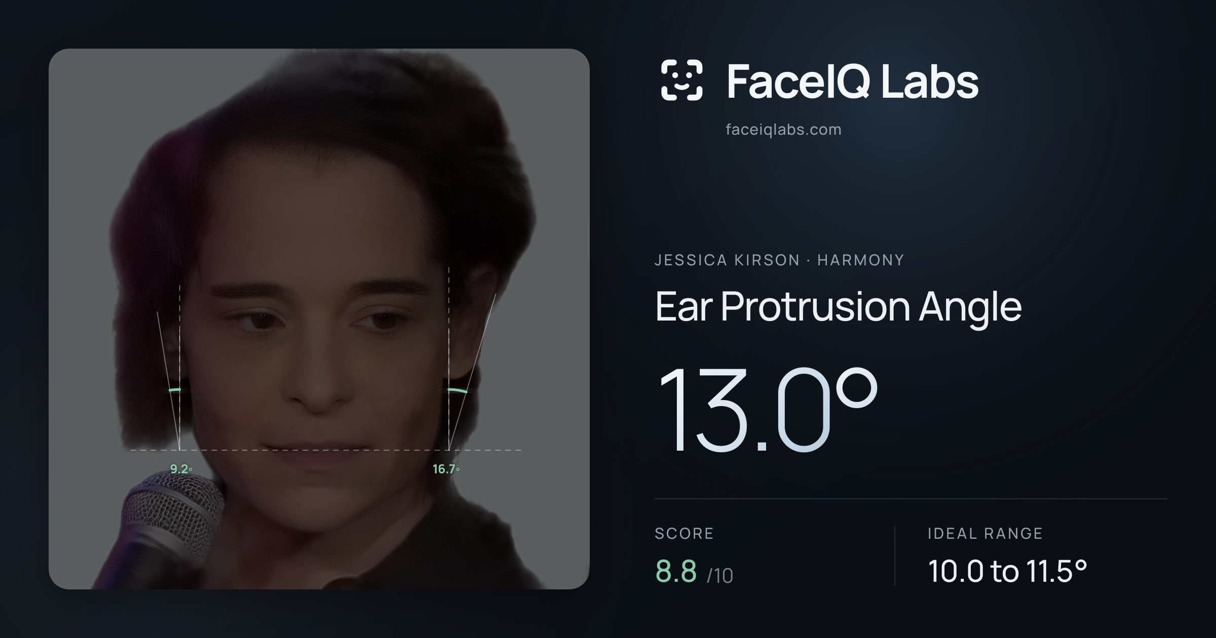Jessica Kirson Ear Protrusion Angle: 13.0°, drawn on the photo