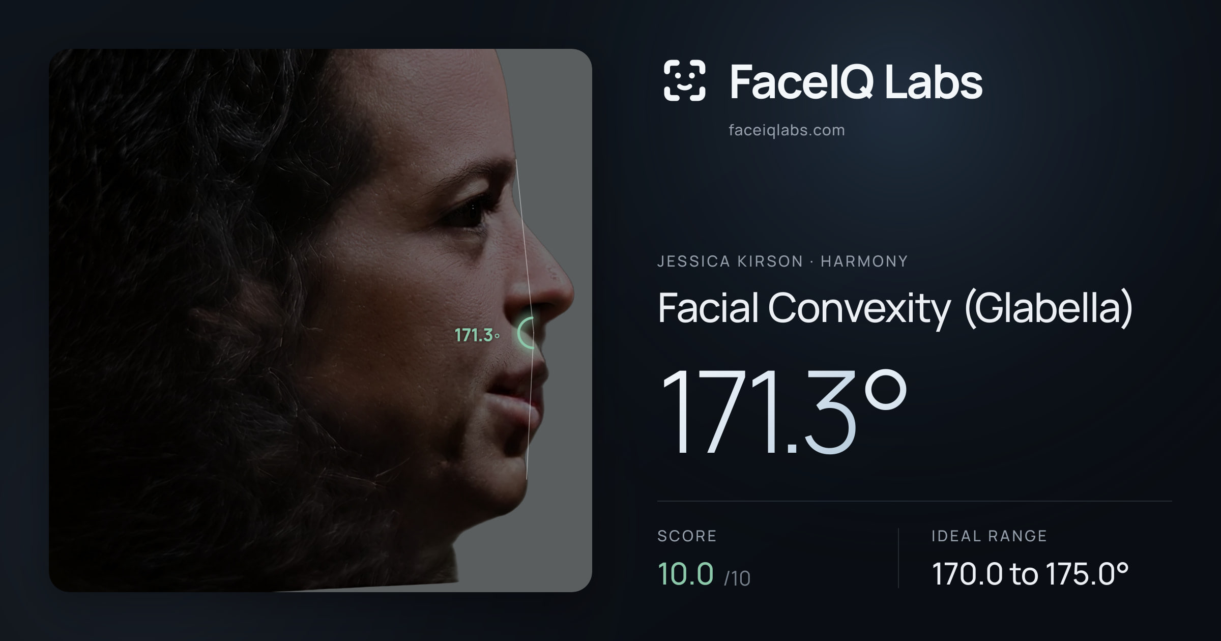 Jessica Kirson Facial Convexity (Glabella): 171.3°, drawn on the photo