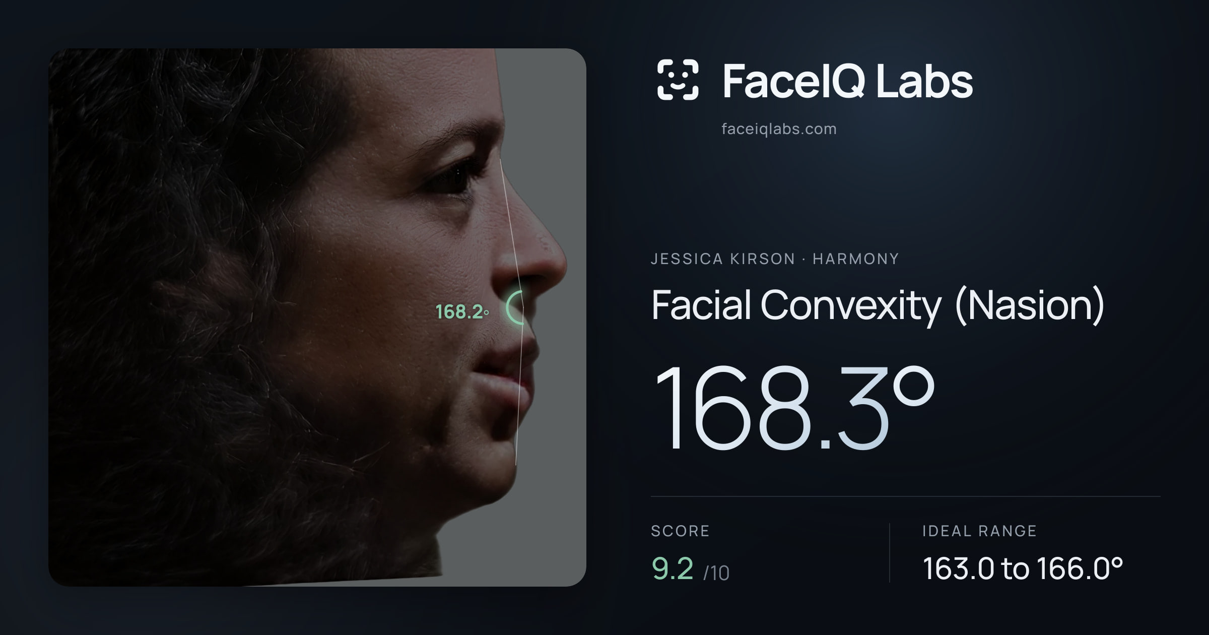 Jessica Kirson Facial Convexity (Nasion): 168.3°, drawn on the photo