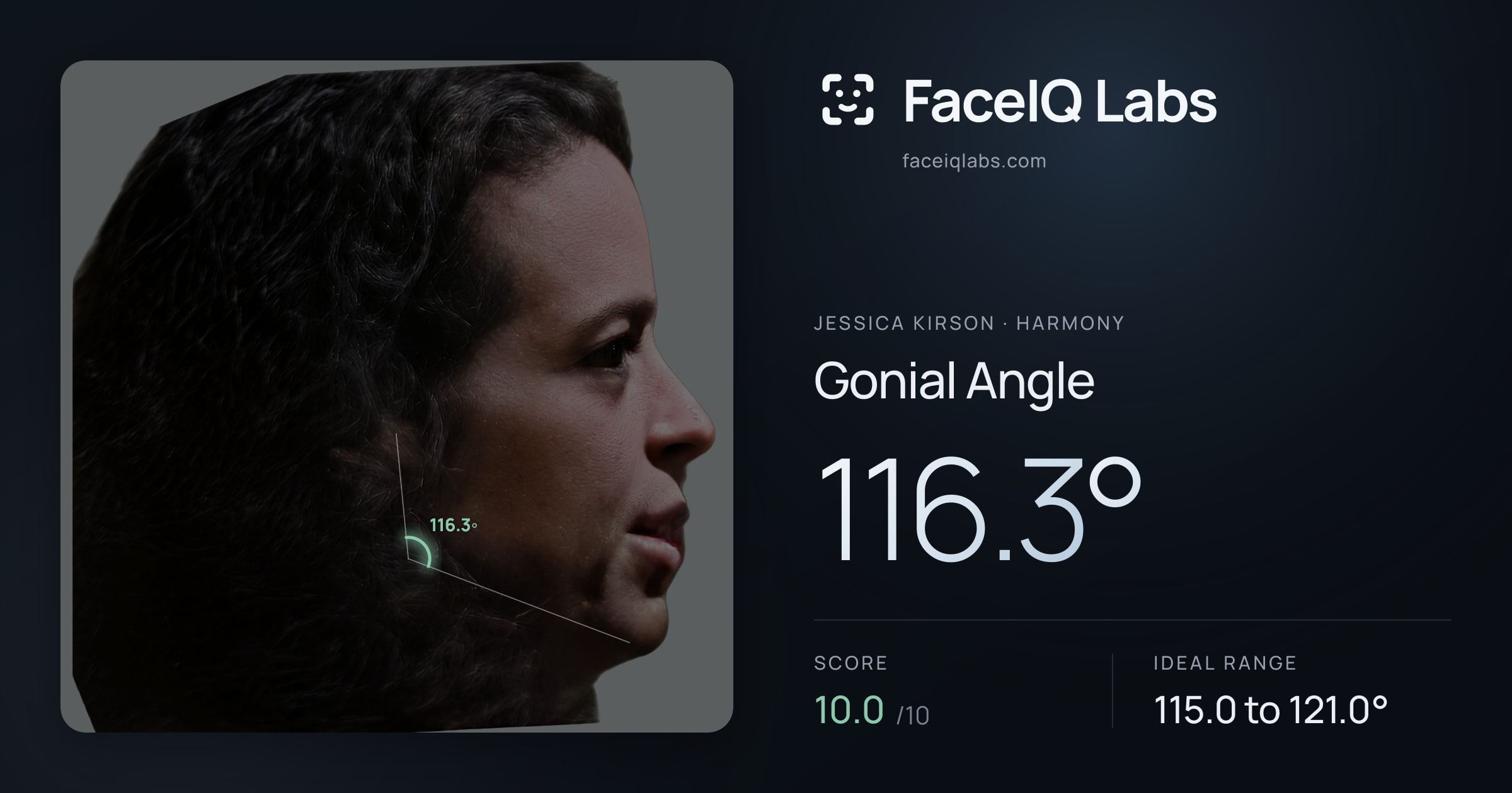 Jessica Kirson Gonial Angle: 116.3°, drawn on the photo