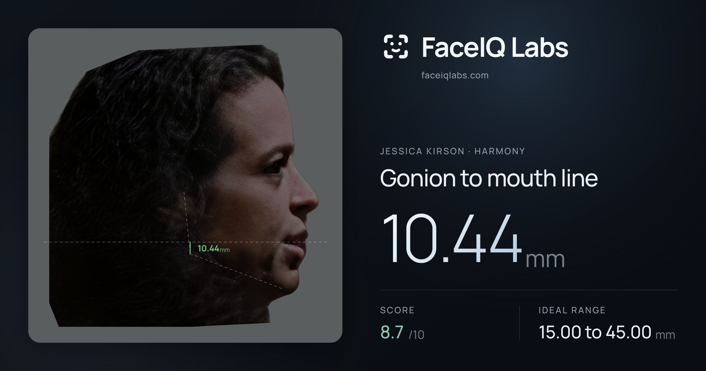 Jessica Kirson Gonion to mouth line: 10.44mm, drawn on the photo