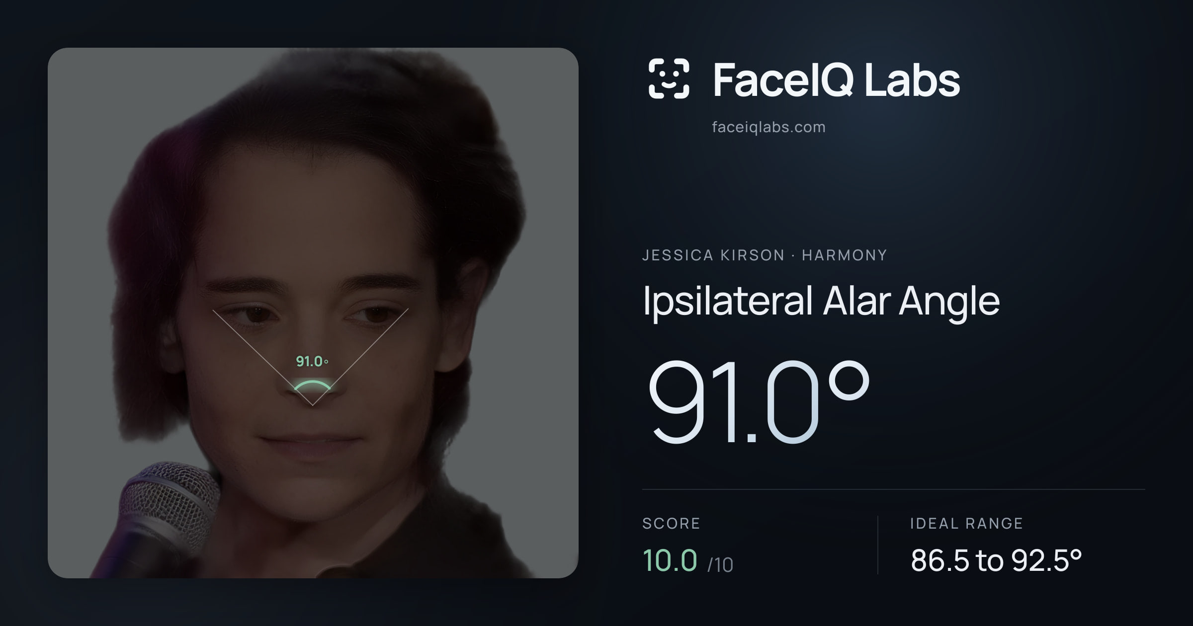 Jessica Kirson Ipsilateral Alar Angle: 91.0°, drawn on the photo