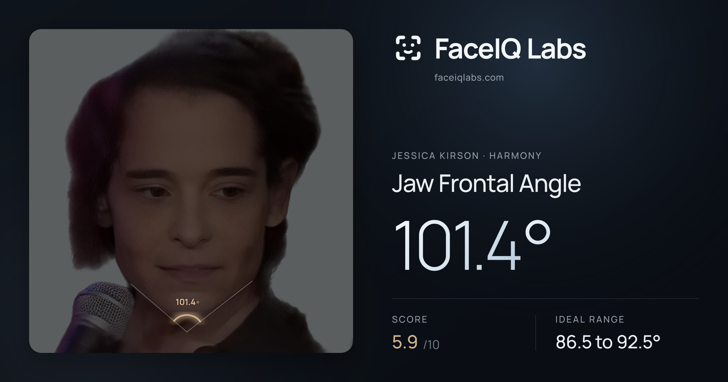 Jessica Kirson Jaw Frontal Angle: 101.4°, drawn on the photo