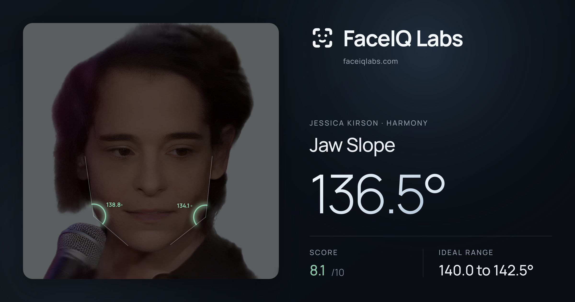 Jessica Kirson Jaw Slope: 136.5°, drawn on the photo