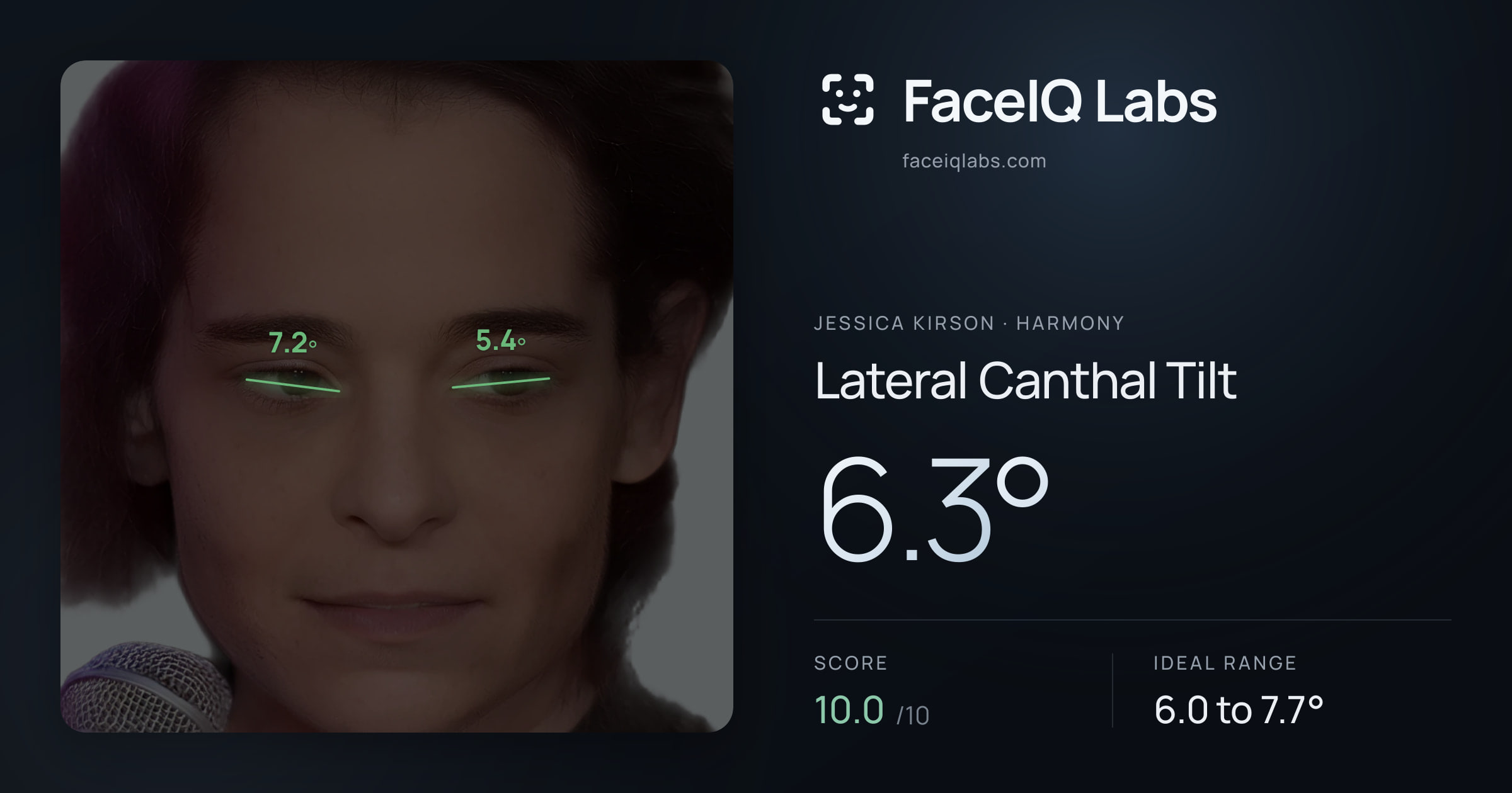 Jessica Kirson Lateral Canthal Tilt: 6.3°, drawn on the photo