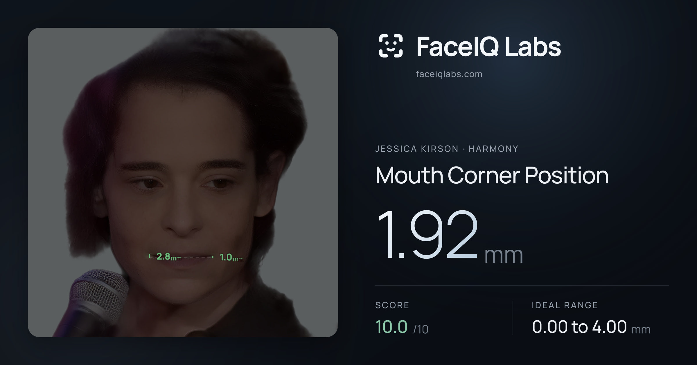 Jessica Kirson Mouth Corner Position: 1.92mm, drawn on the photo