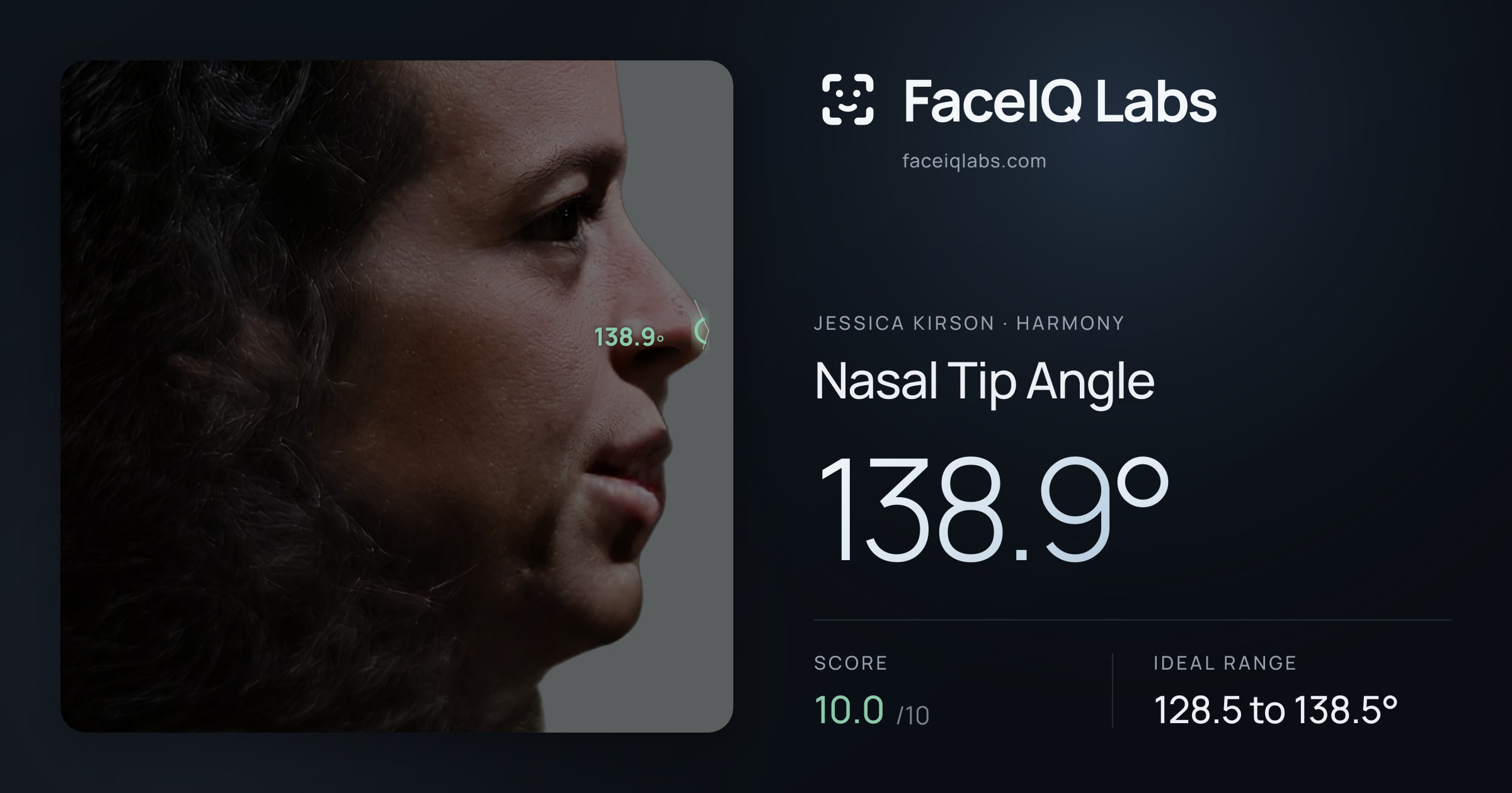 Jessica Kirson Nasal Tip Angle: 138.9°, drawn on the photo