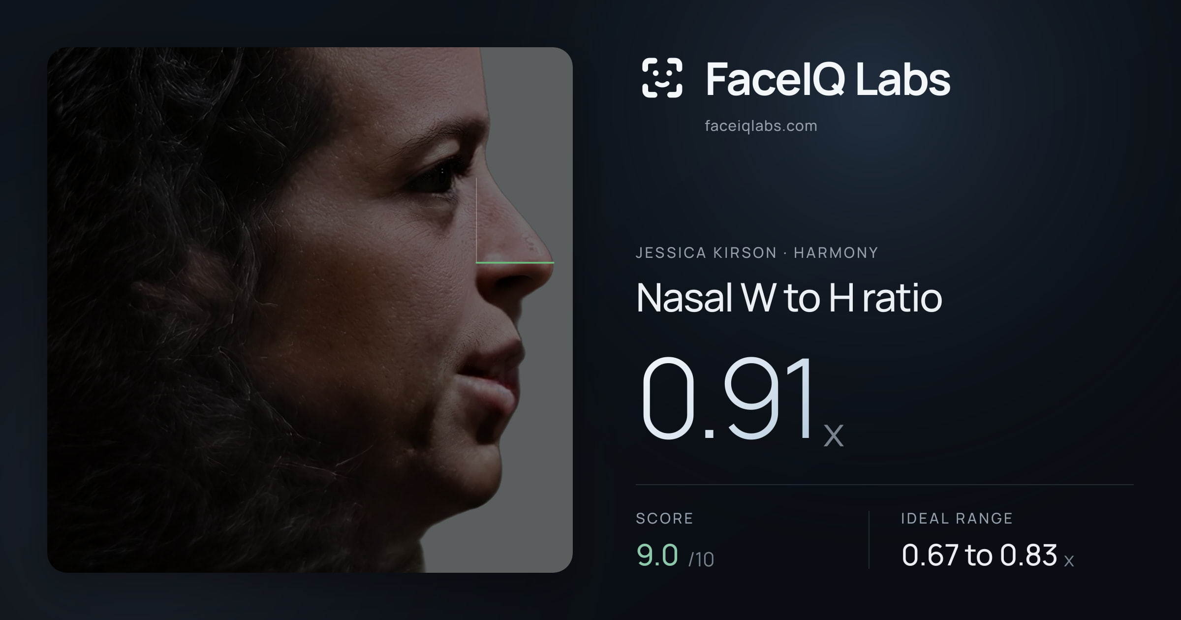 Jessica Kirson Nasal W to H ratio: 0.91x, drawn on the photo