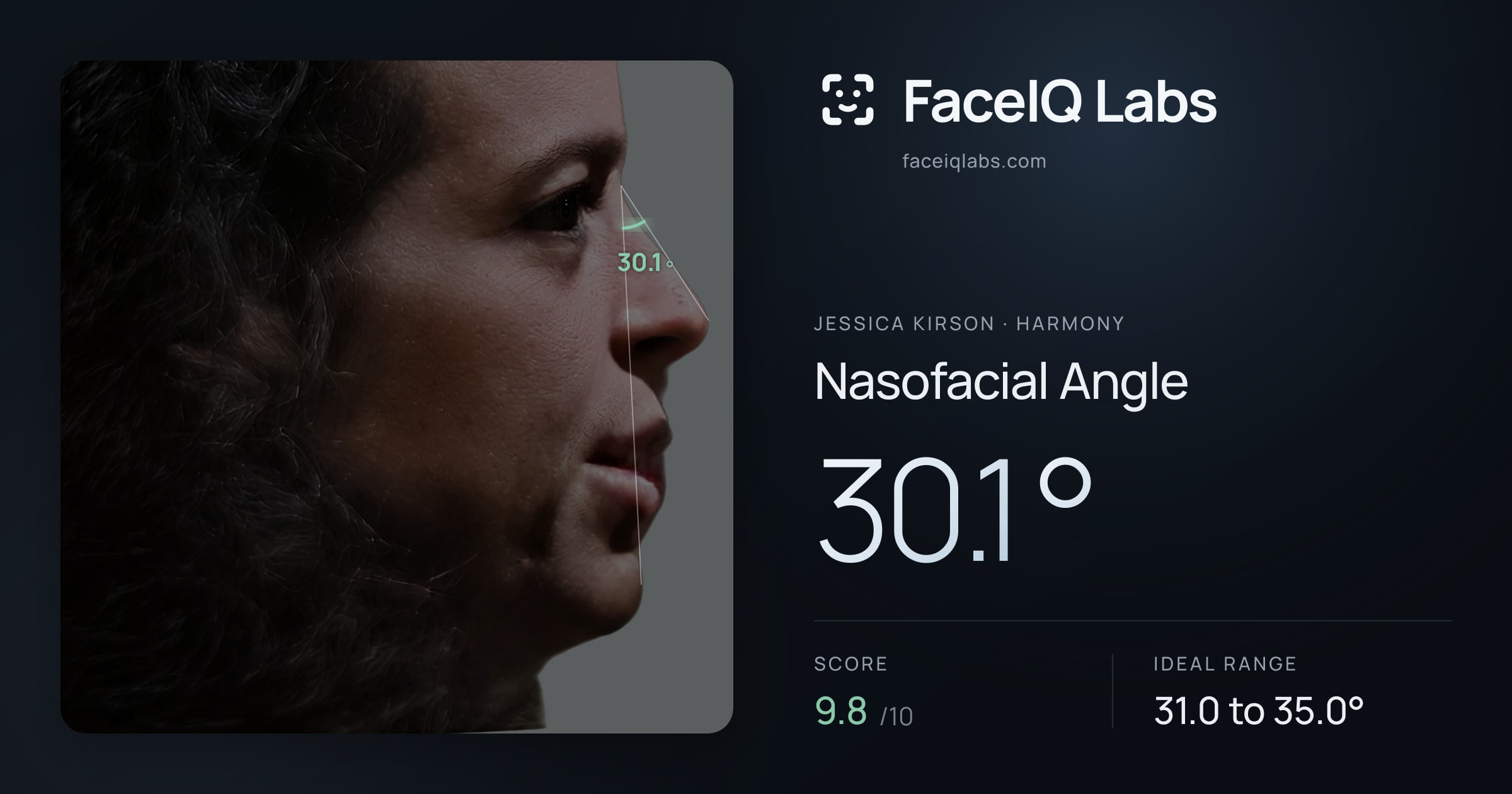Jessica Kirson Nasofacial Angle: 30.1°, drawn on the photo