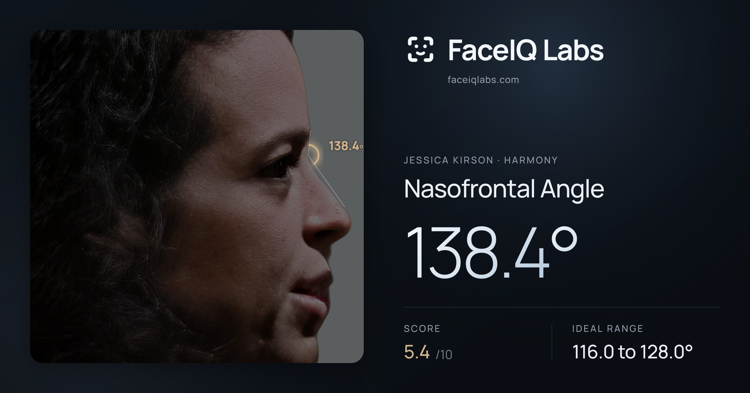Jessica Kirson Nasofrontal Angle: 138.4°, drawn on the photo