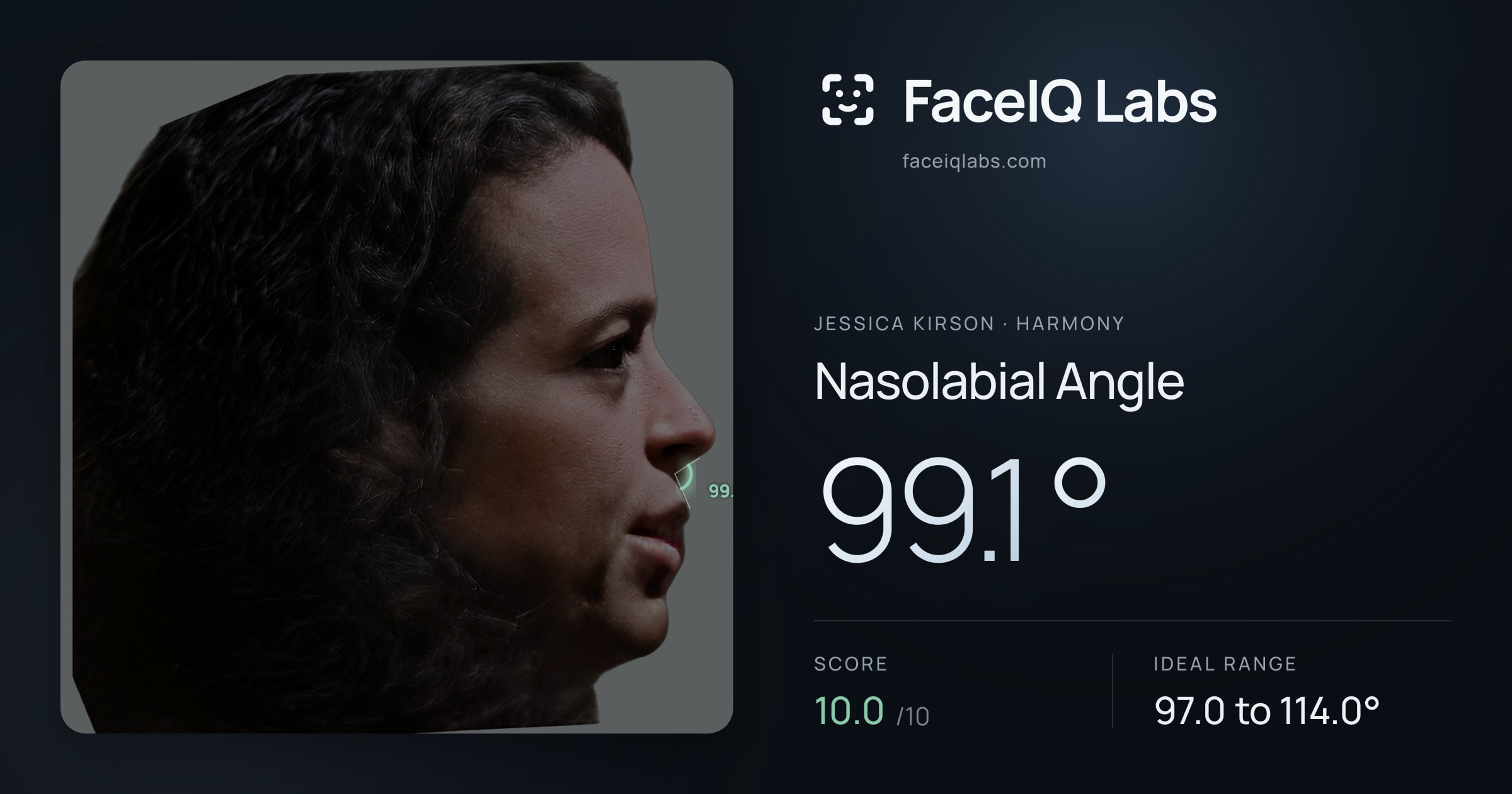 Jessica Kirson Nasolabial Angle: 99.1°, drawn on the photo