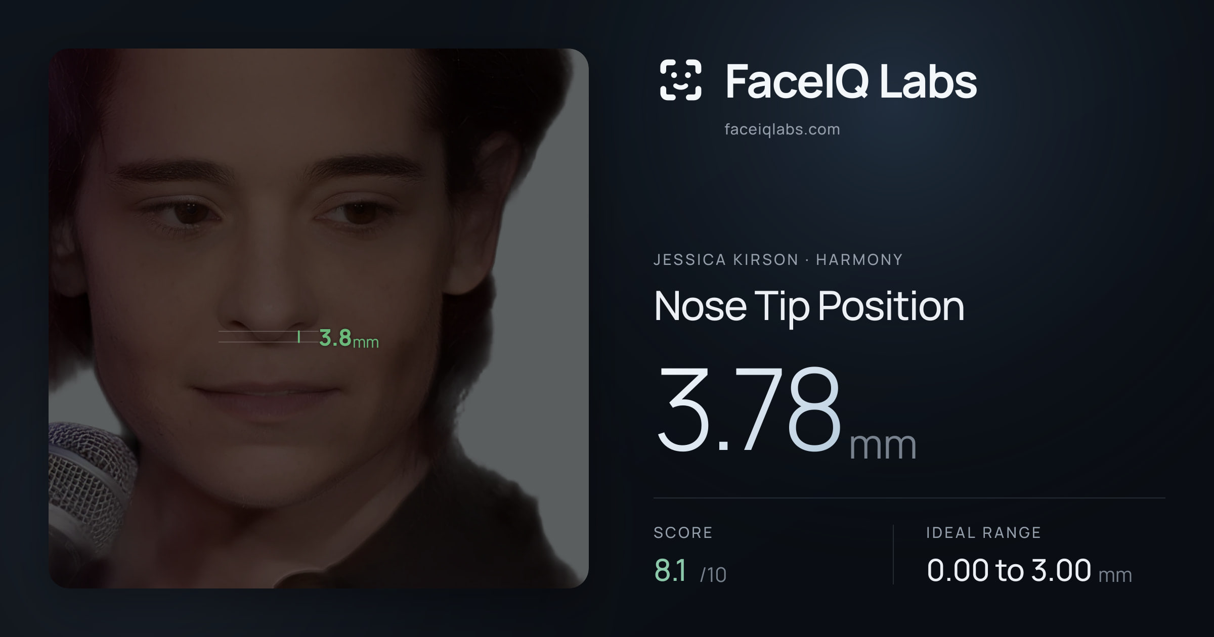 Jessica Kirson Nose Tip Position: 3.78mm, drawn on the photo