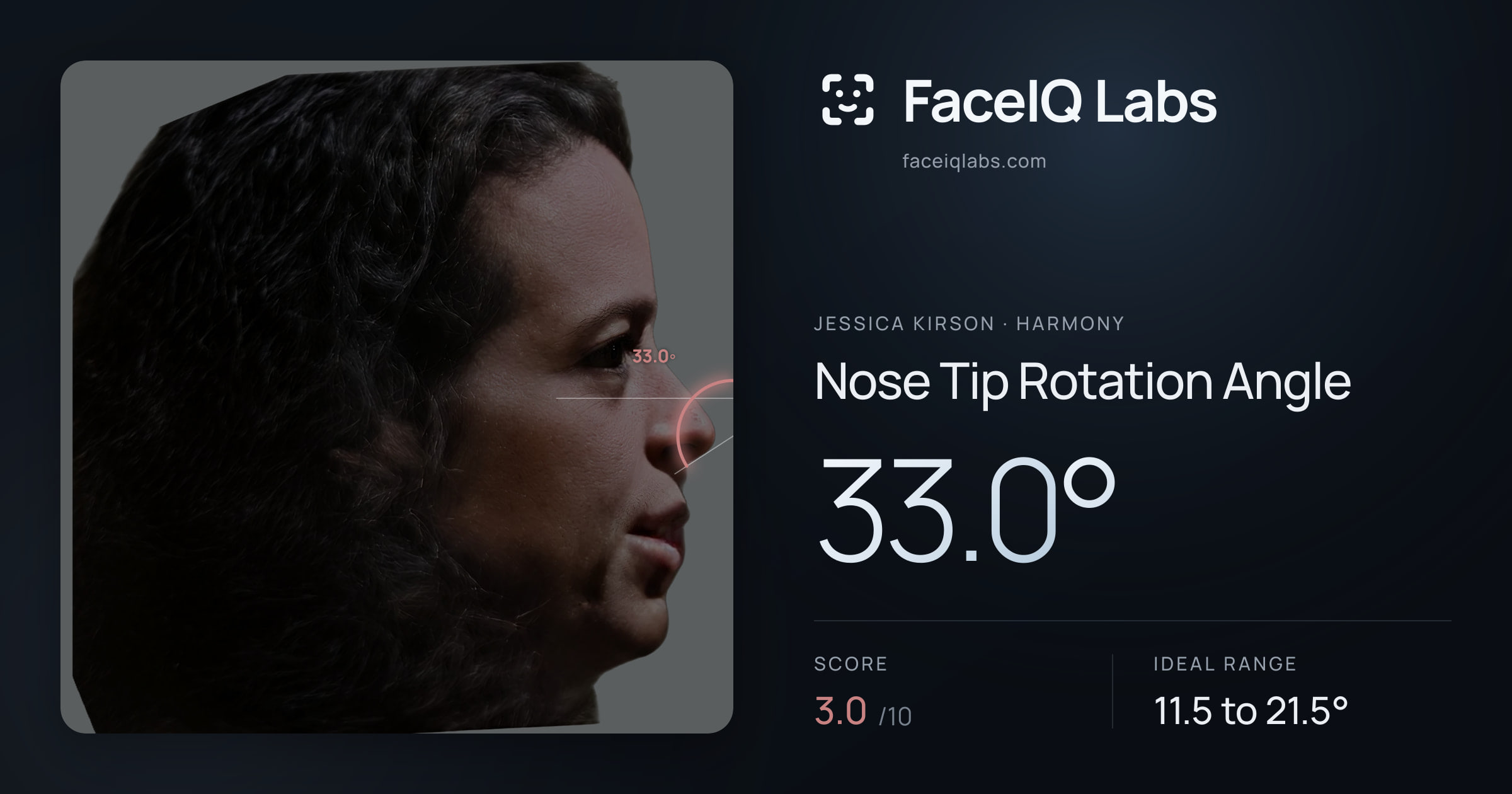 Jessica Kirson Nose Tip Rotation Angle: 33.0°, drawn on the photo