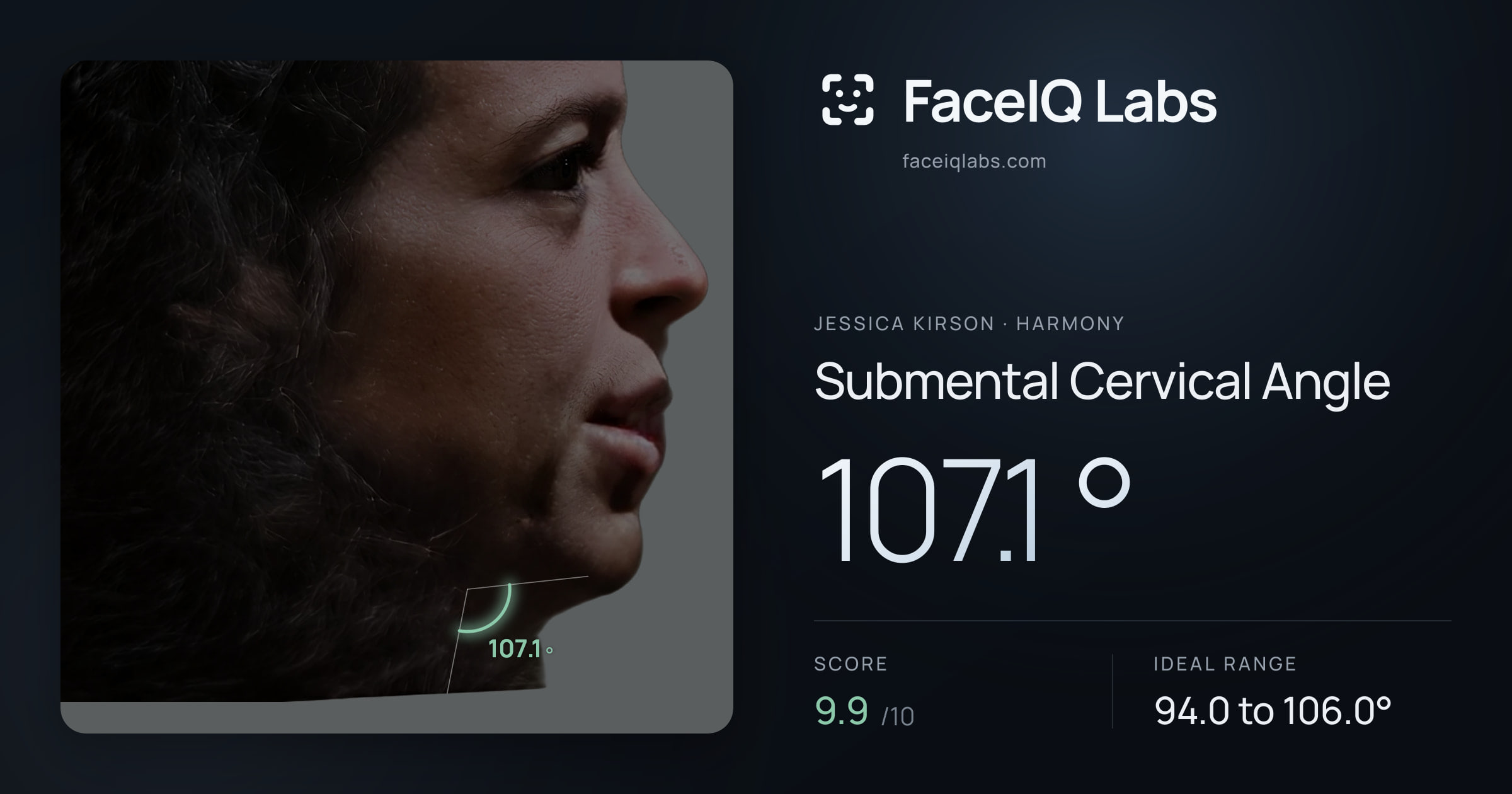 Jessica Kirson Submental Cervical Angle: 107.1°, drawn on the photo