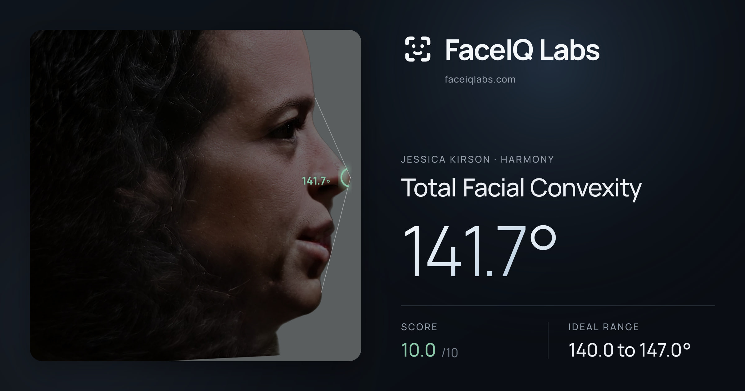 Jessica Kirson Total Facial Convexity: 141.7°, drawn on the photo