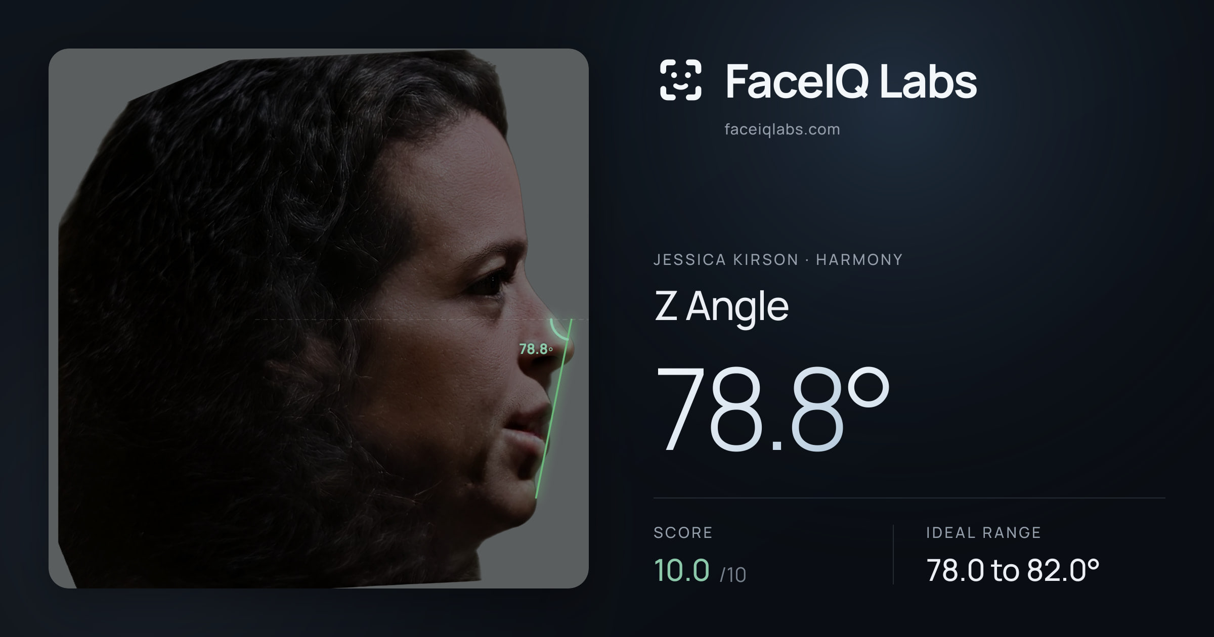 Jessica Kirson Z Angle: 78.8°, drawn on the photo