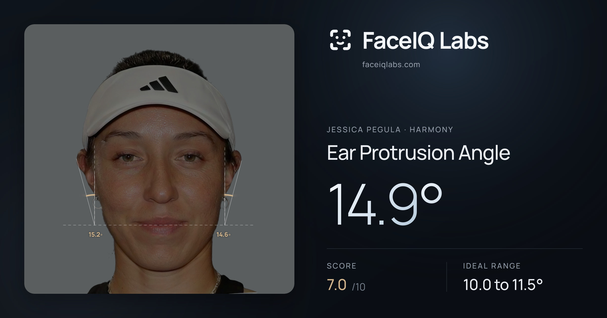 Jessica Pegula Ear Protrusion Angle: 14.9°, drawn on the photo