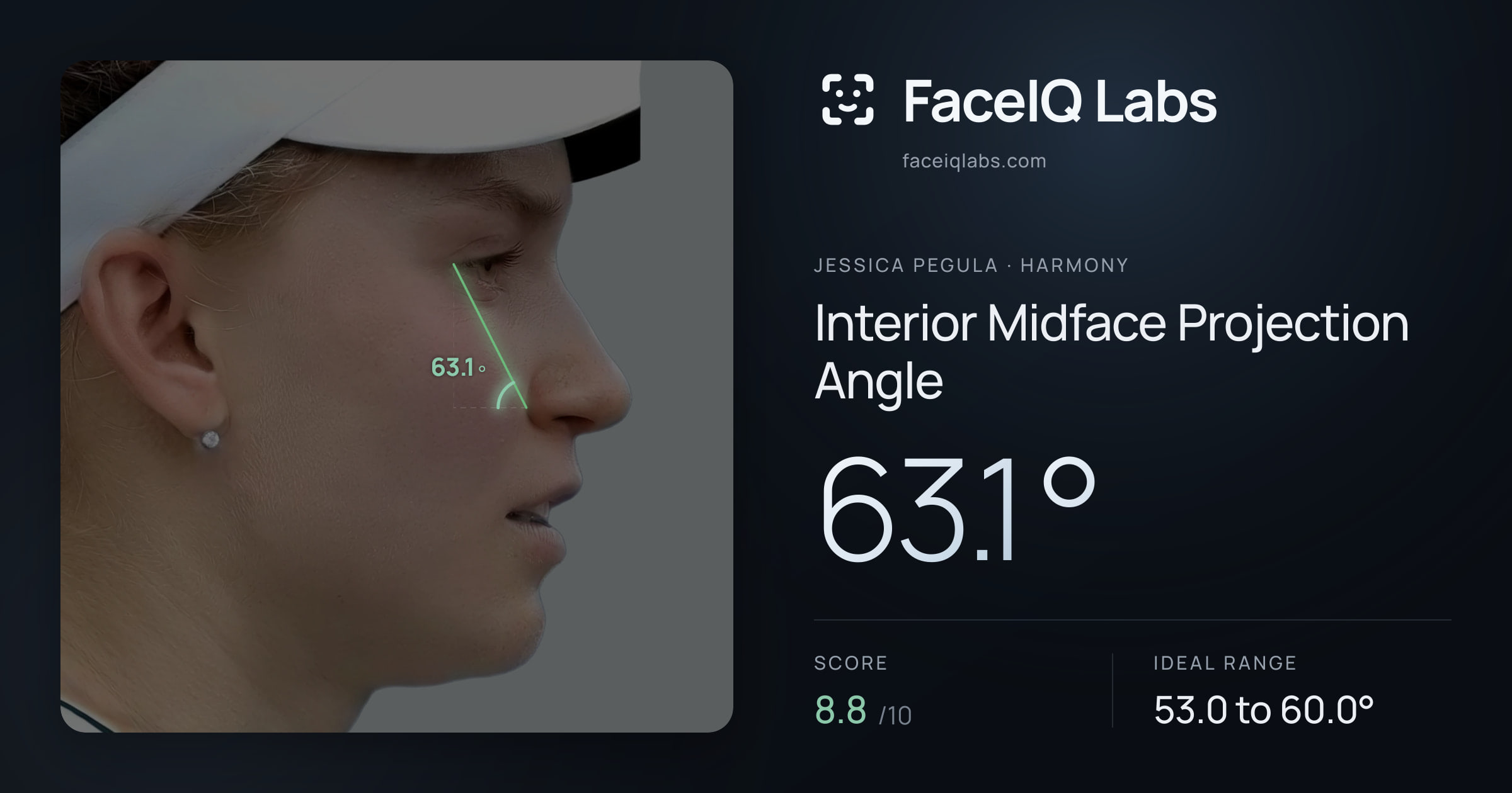 Jessica Pegula Interior Midface Projection Angle: 63.1°, drawn on the photo