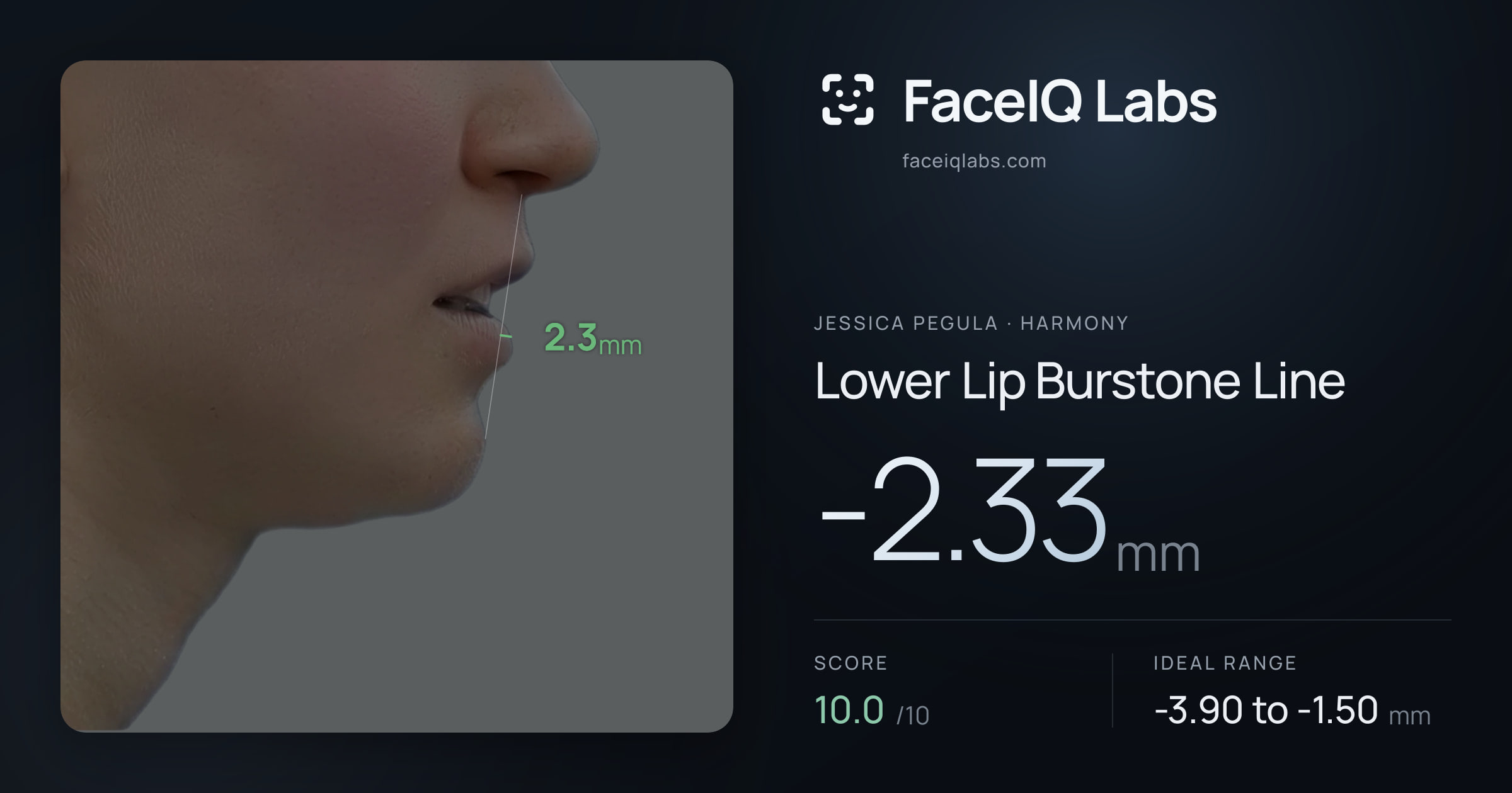 Jessica Pegula Lower Lip Burstone Line: -2.33mm, drawn on the photo